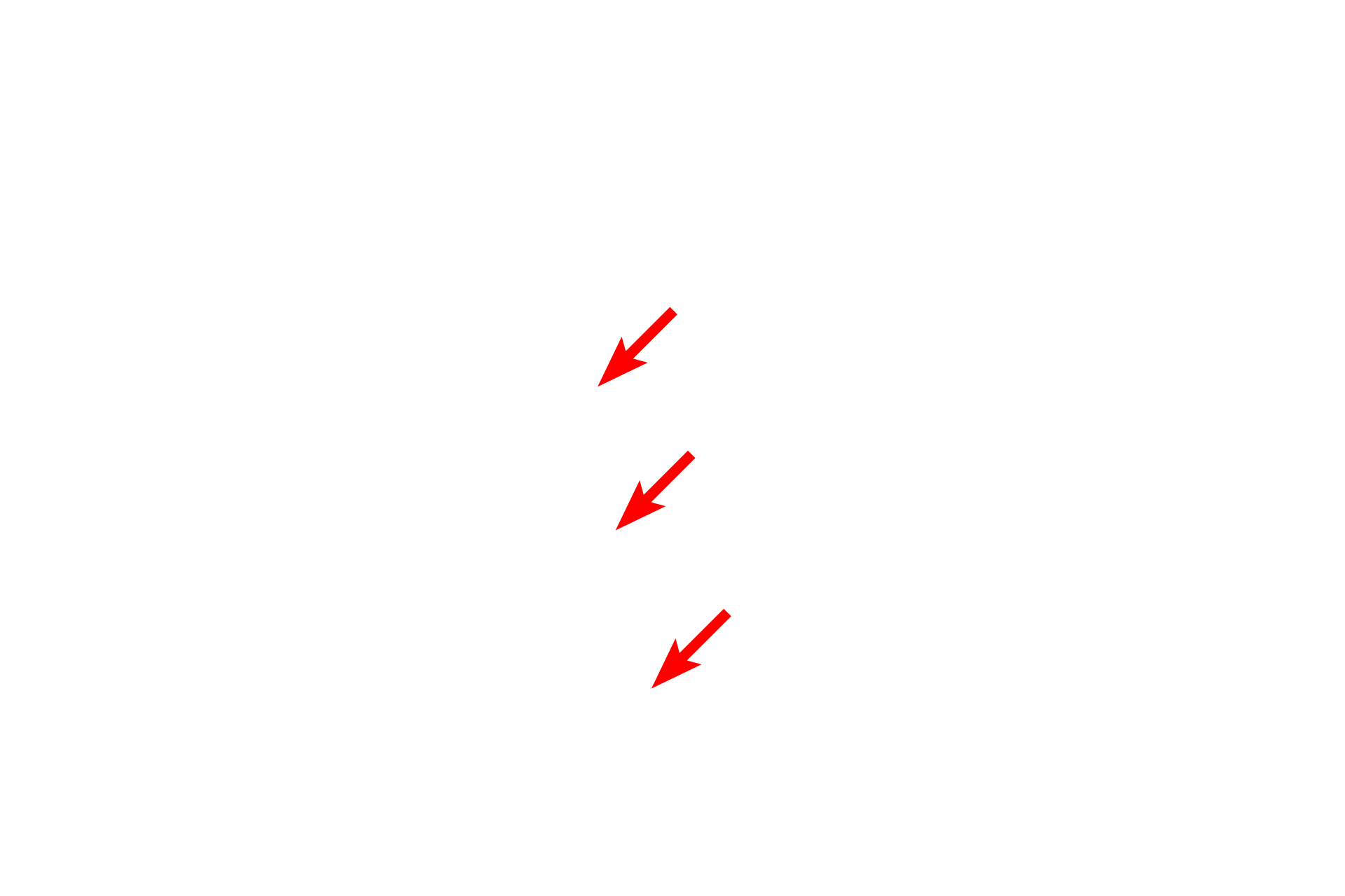  - M line <p>The sarcomere is the contractile unit of striated muscle and extends from one Z line to an adjacent Z line. During contraction, the width of the sarcomere narrows. The width of the A band remains constant, but both the I and H bands narrow as the areas of overlap of thin and thick myofilaments increase.</p>
