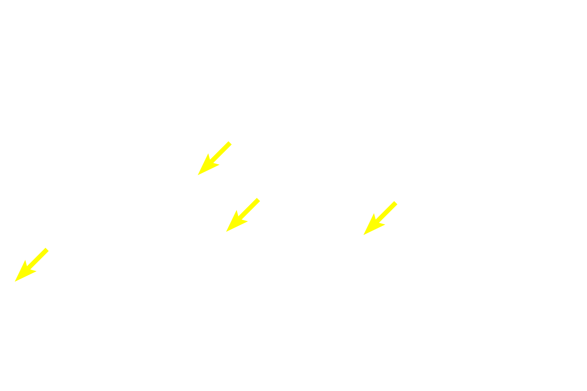  - Nuclei > <p>Multiple nuclei are located at the periphery of each muscle fiber. </p>

