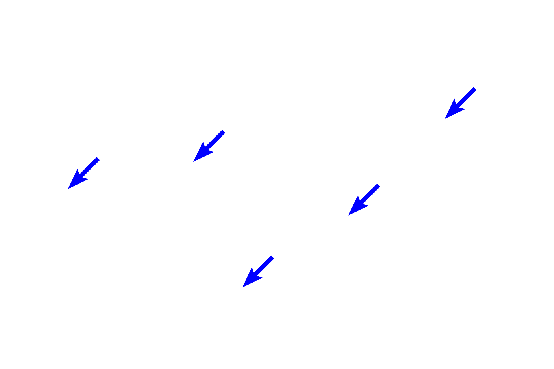 Artifactual space <p>Clear spaces in the image are the result of shrinkage during tissue processing.</p>
