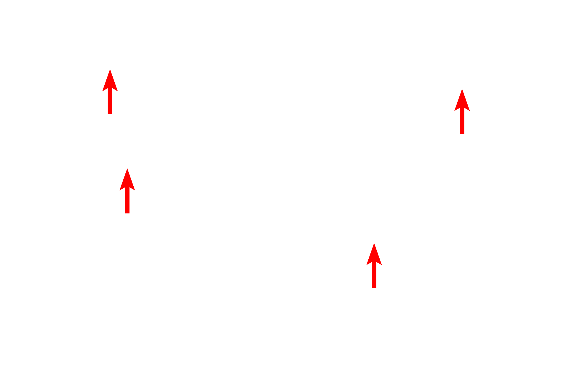 Myofilaments > <p>The cytoplasm of smooth muscle fibers is filled with interlacing, overlapping myofilaments.  Unlike striated muscles, these filaments are not organized into myofibrils.  Myosin filaments are scattered throughout the sarcoplasm.  Actin myofilaments are anchored in alpha-actinin containing dense bodies located in the cytoplasm and beneath the plasma membrane.</p>

