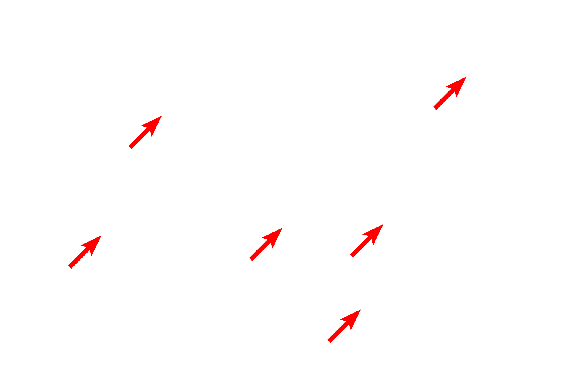 Dense bodies <p>The cytoplasm of smooth muscle fibers is filled with interlacing, overlapping myofilaments.  Unlike striated muscles, these filaments are not organized into myofibrils.  Myosin filaments are scattered throughout the sarcoplasm.  Actin myofilaments are anchored in alpha-actinin containing dense bodies located in the cytoplasm and beneath the plasma membrane.</p>
