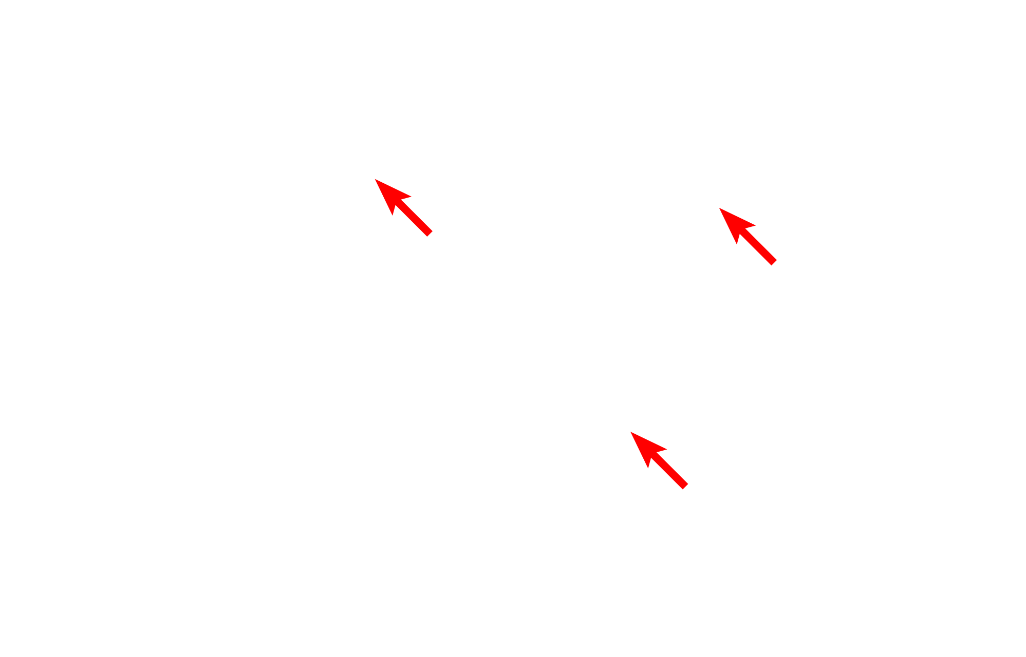 Myofilaments > <p>Actin and myosin myofilaments fill the cytoplasm of smooth muscle fibers but are not organized into distinct myofibrils.  The overlapping actin and myosin myofilaments criss-cross through the cytoplasm and the actin filaments are anchored in cytoplasmic and plasma membrane-associated dense bodies composed of alpha-actinin.</p>
