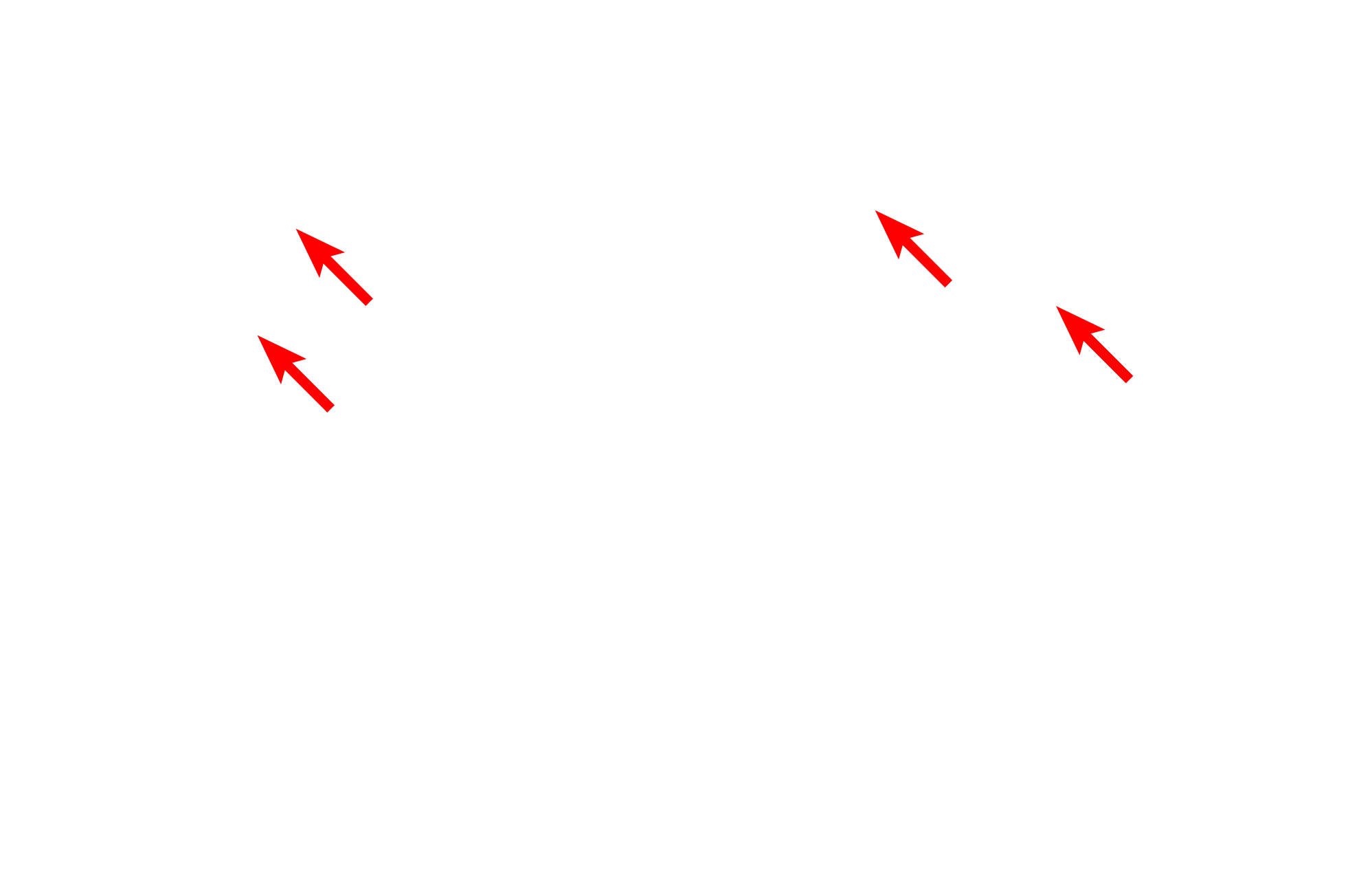 Dense bodies <p>Actin and myosin myofilaments fill the cytoplasm of smooth muscle fibers but are not organized into distinct myofibrils.  The overlapping actin and myosin myofilaments criss-cross through the cytoplasm and the actin filaments are anchored in cytoplasmic and plasma membrane-associated dense bodies composed of alpha-actinin.</p>
