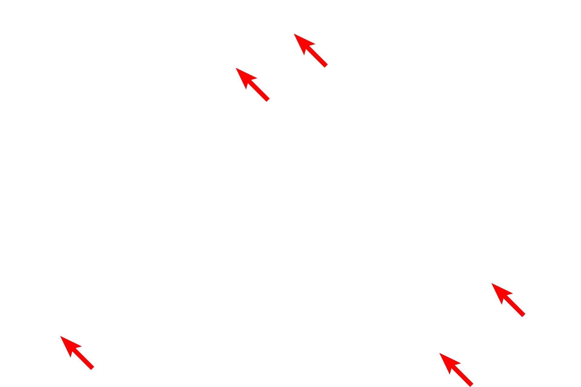 Sarcolemma <p>The myofilaments of smooth cell fibers are not organized into myofibrils; instead, the overlapping thick and thin filaments form a reticulum within the sarcoplasm.  Actin filaments are anchored in dense bodies, which represent Z lines of striated muscle.  Dense bodies are located both in the sarcoplasm and beneath the sarcolemma.  7000x</p>
