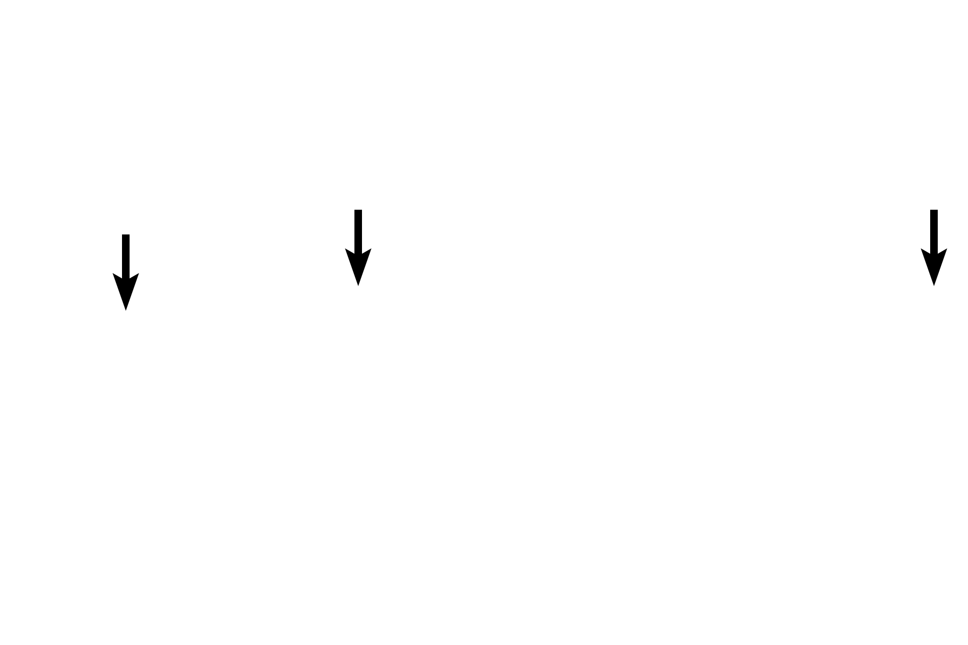 Autonomic ganglion and nerves <p>Smooth muscle, the most widespread of the muscle types, is often organized into perpendicularly oriented sheets in the walls of tubular organs.  In such locations, the muscle mixes and propels luminal contents.  Here, a cross section of small intestine shows inner circular and outer longitudinal smooth muscle sheets forming much of the intestinal wall.  400x</p>

