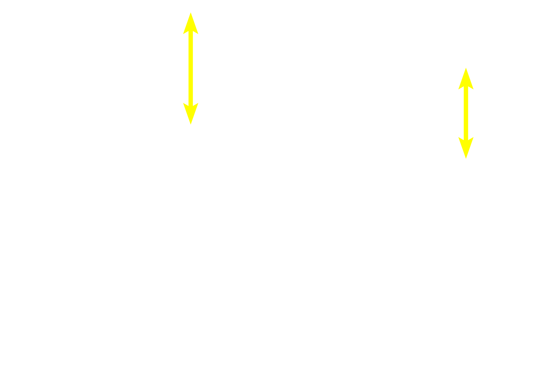 Longitudinal fascicles <p>Smooth muscle can also be arranged as interlacing fascicles as seen here in the urinary bladder.  Note the more palely staining connective tissue surrounding the fascicles and a peripheral nerve passing through the center of the field.  200x</p>
