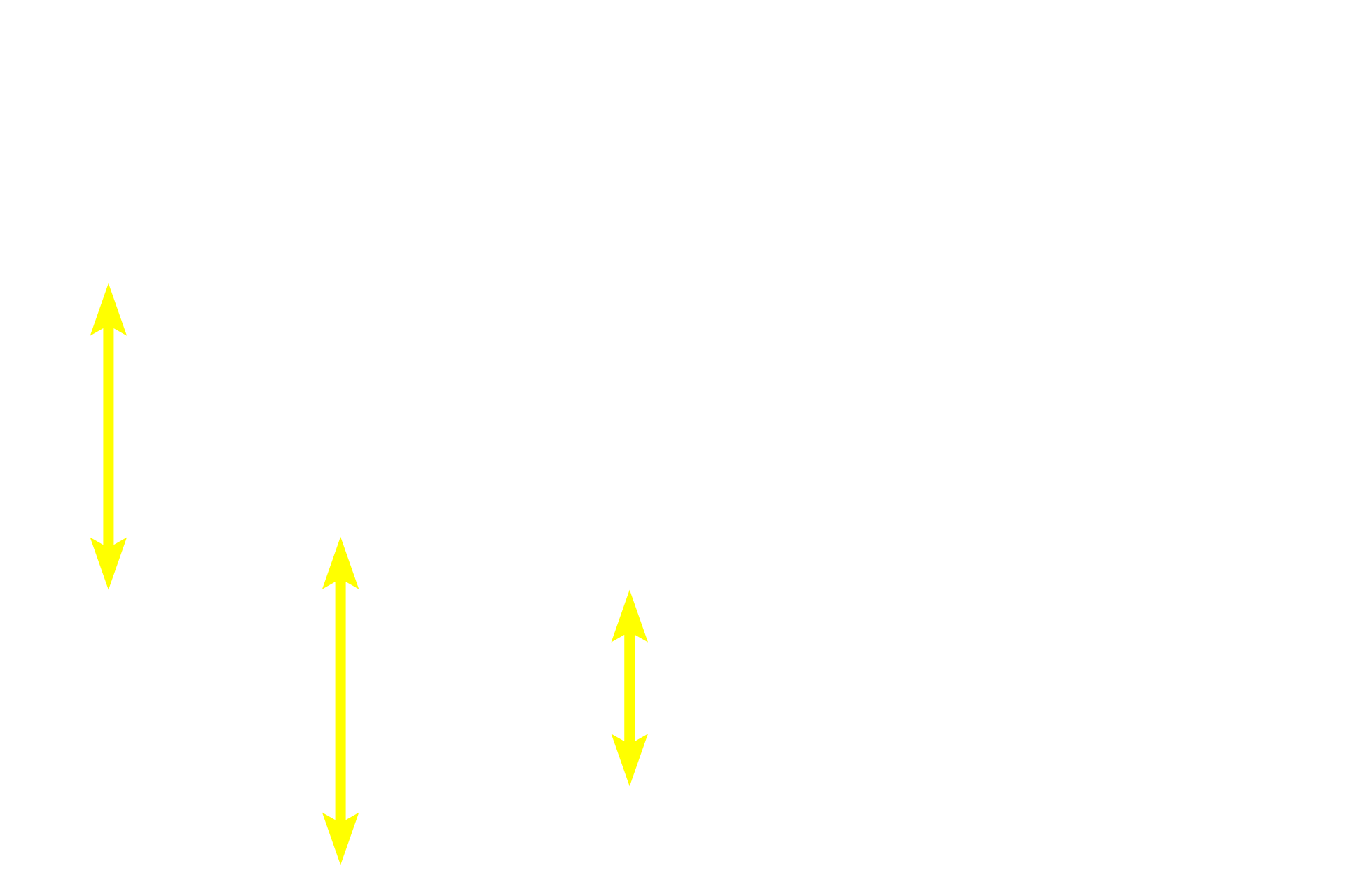 Transverse fascicles <p>Smooth muscle can also be arranged as interlacing fascicles as seen here in the urinary bladder.  Note the more palely staining connective tissue surrounding the fascicles and a peripheral nerve passing through the center of the field.  200x</p>
