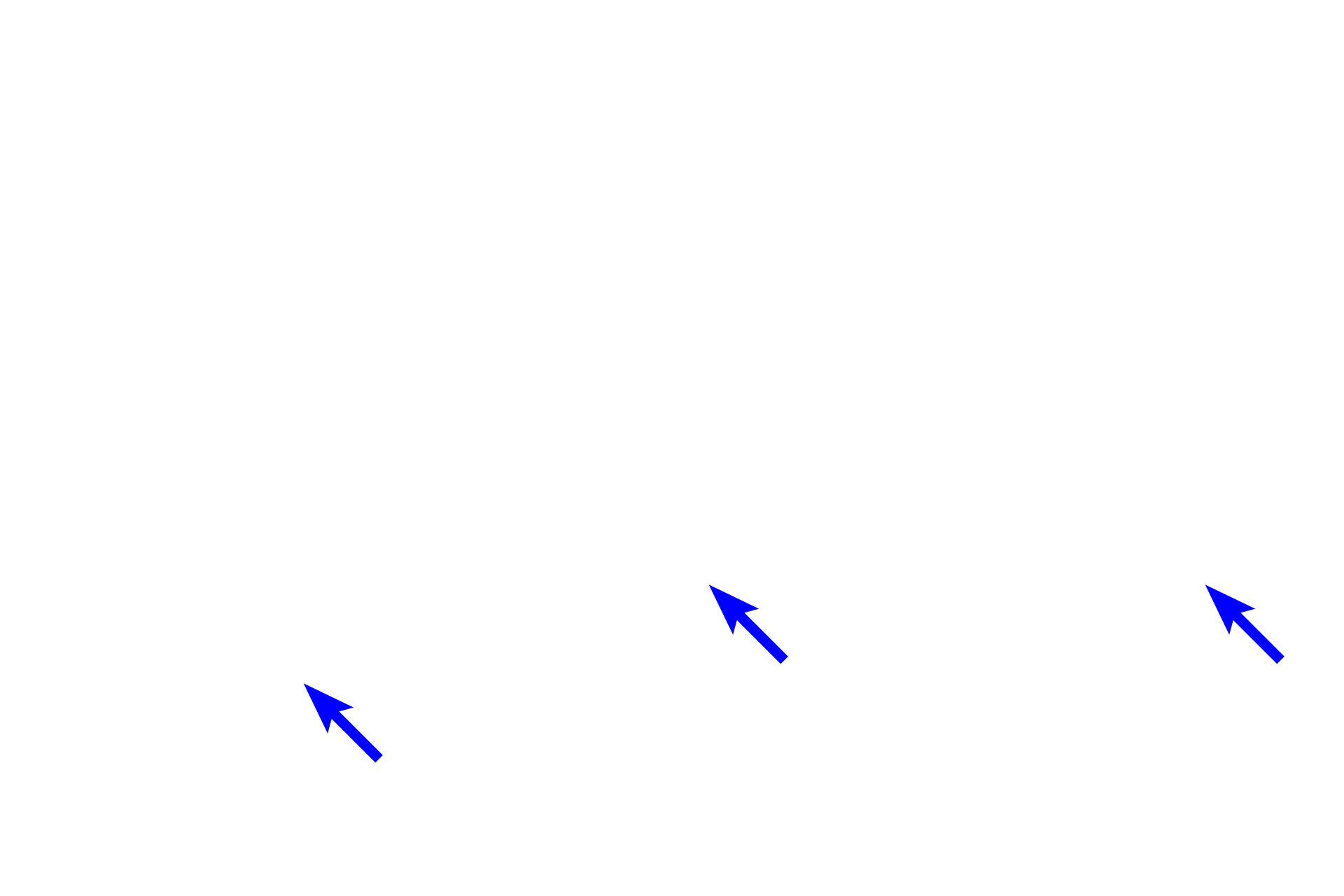 Smooth muscle fibers <p>Smooth muscle is also found forming a thin layer in connective tissue near the luminal surface of hollow organs, such as those in the digestive or respiratory systems. In this field, the fascicles are cut in cross section.  Also visible are two mast cells as well as numerous small blood vessels.  1000x</p>
