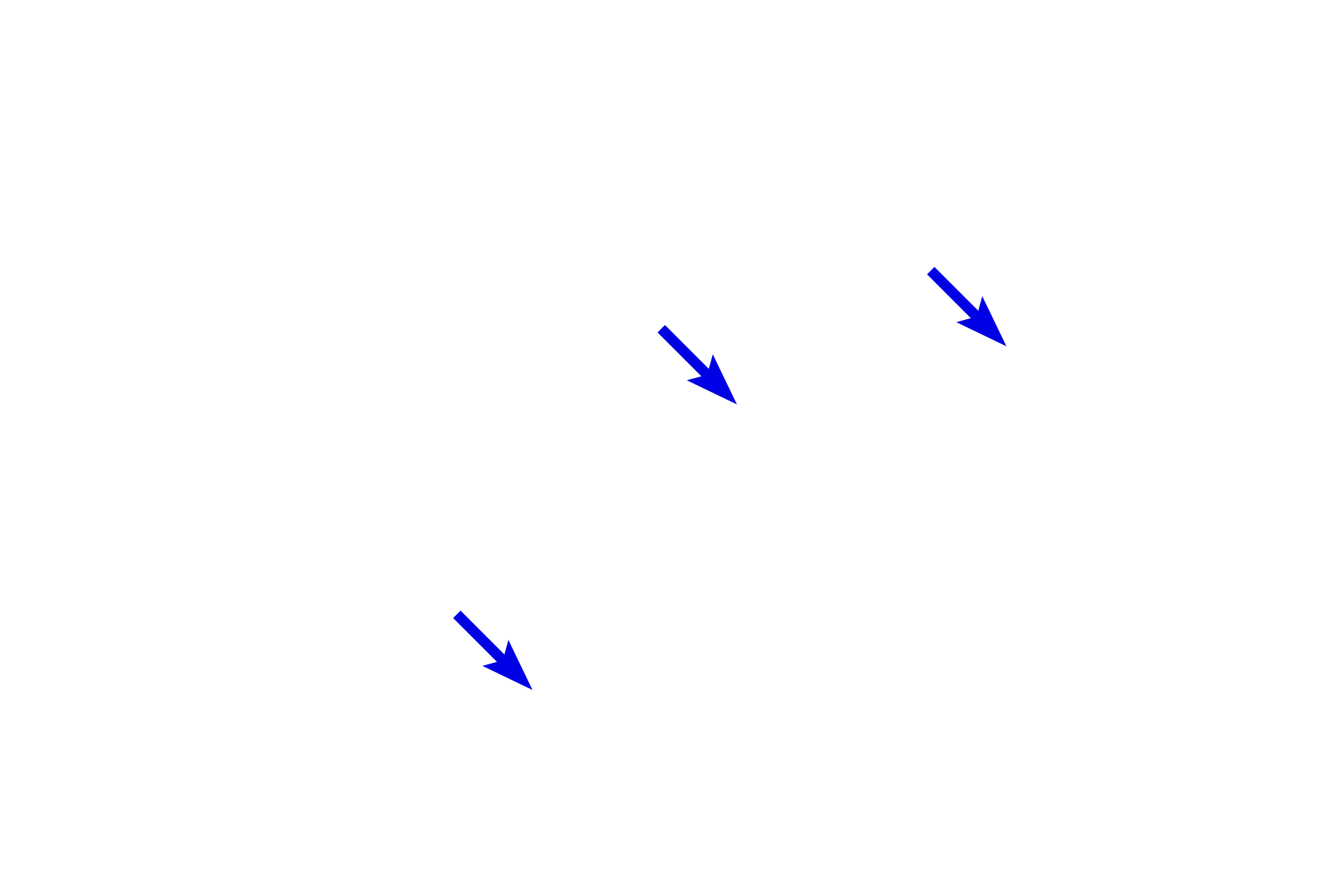 Skeletal muscle fibers <p>Smooth muscle fibers and skeletal muscle fibers occur together in the middle part of the esophagus.  In this field, compare the size of the fibers and location of the nuclei for these two muscle types.  Smooth muscle fibers are much smaller with a single, centrally located nucleus.  Skeletal muscle fibers are larger with multiple, peripherally located nuclei.  1000x</p>
