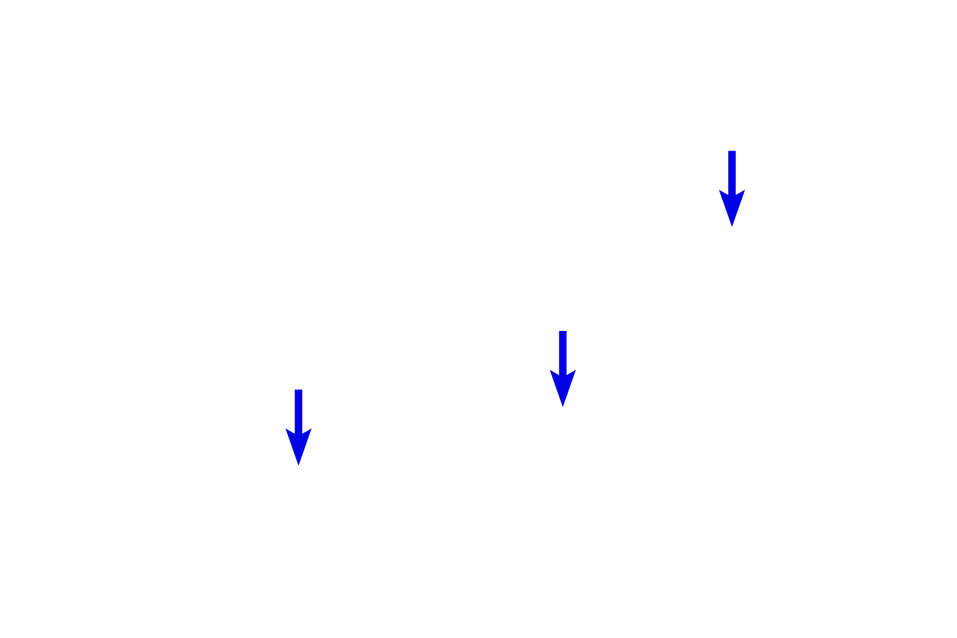 Skeletal muscle nuclei <p>Smooth muscle fibers and skeletal muscle fibers occur together in the middle part of the esophagus.  In this field, compare the size of the fibers and location of the nuclei for these two muscle types.  Smooth muscle fibers are much smaller with a single, centrally located nucleus.  Skeletal muscle fibers are larger with multiple, peripherally located nuclei.  1000x</p>
