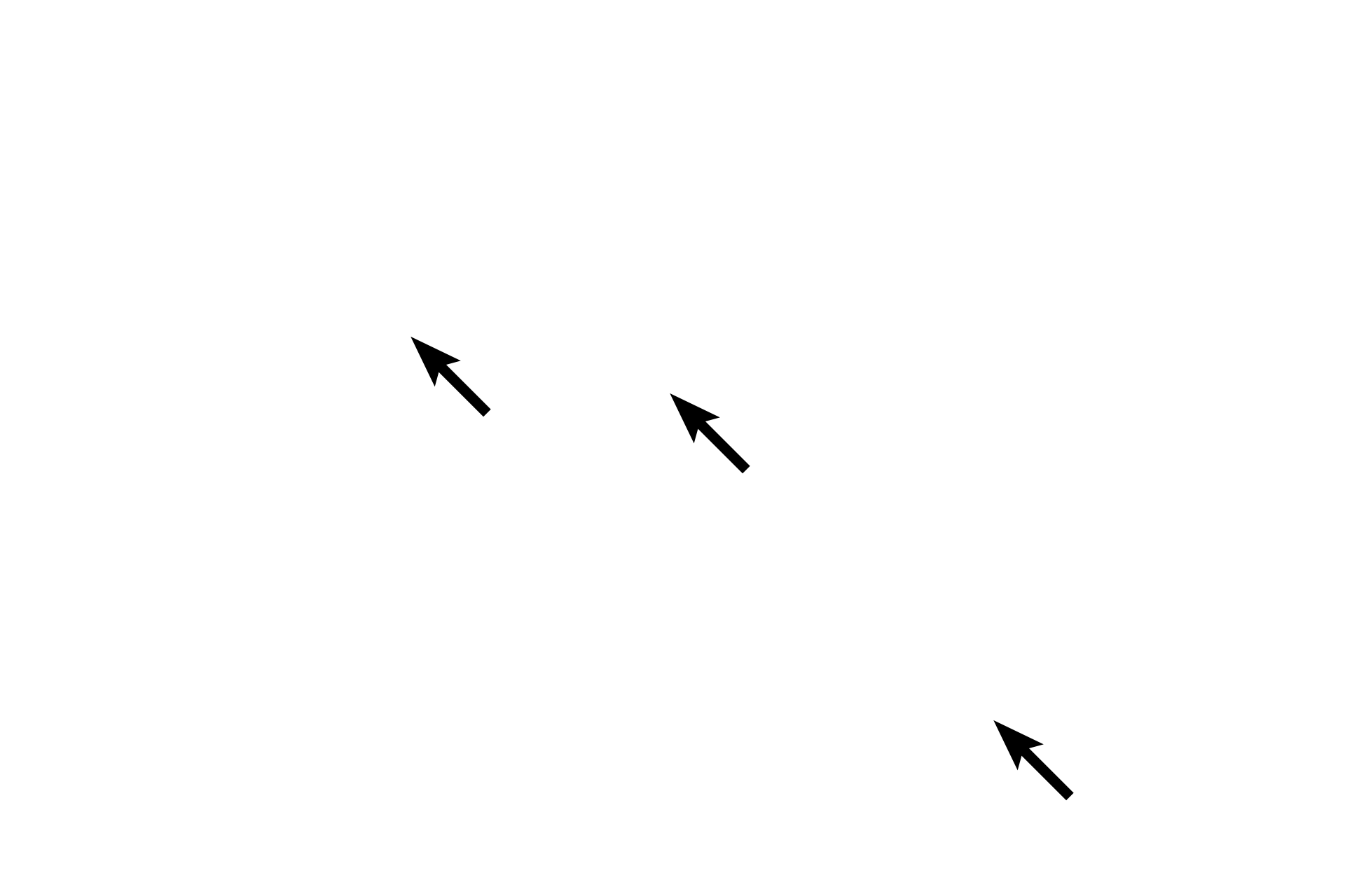 Nuclei <p>Smooth muscle tissue has very little intervening connective tissue.  The muscle fibers are spindle-shaped, which allows them to tightly interlace.  This H&E stained, longitudinal section shows the single, central nucleus located midway along the length of the fiber, which appears homogeneous or smooth, lacking cross striations.  1000x</p>
