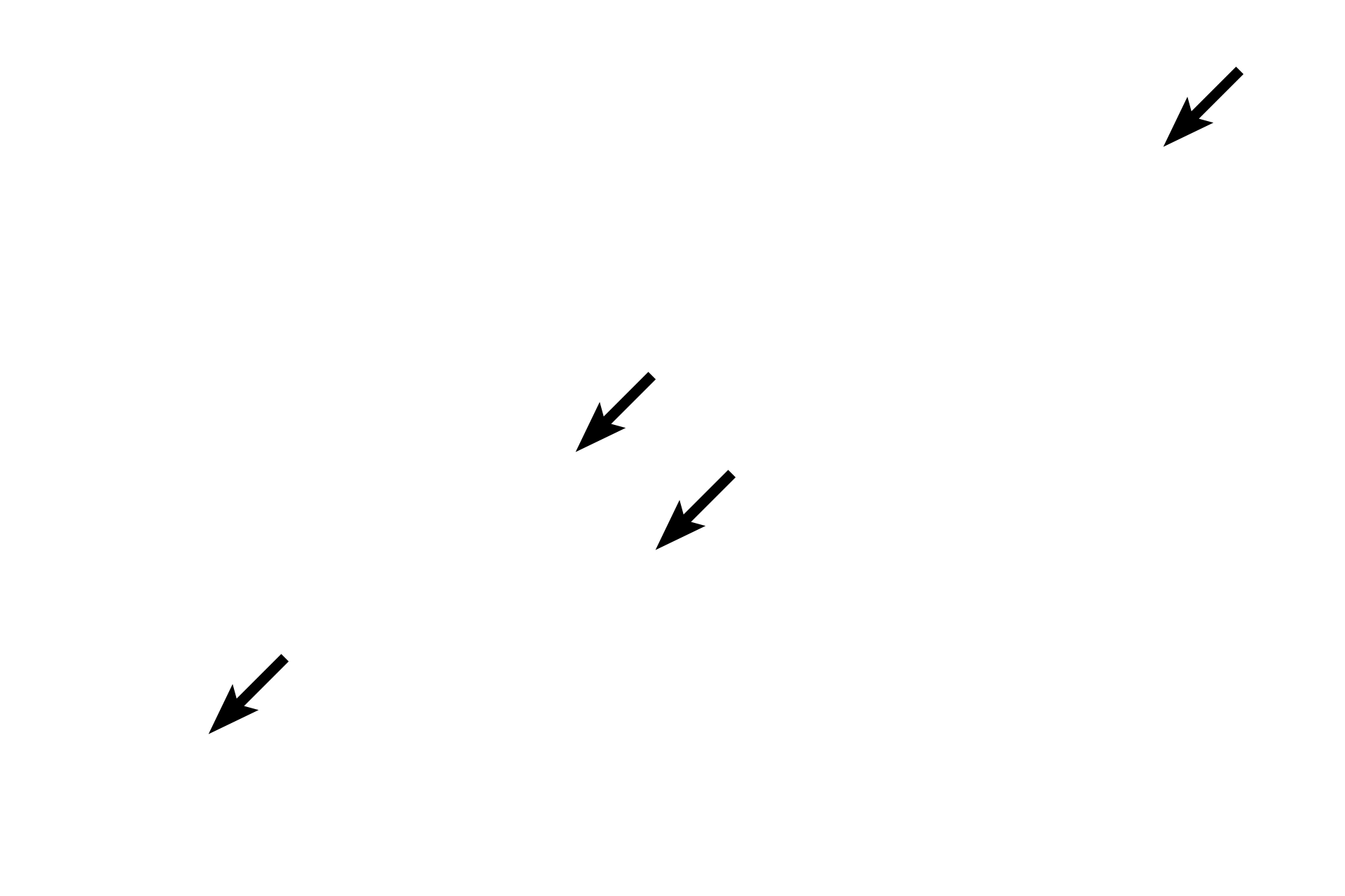 Muscle fibers <p>A unique feature of smooth muscle fibers is the presence of “inch-worm” nuclei. This appearance is caused by the criss-crossing of myofilaments in the cytoplasm deforming the nucleus during contraction.  The central, “inch-worm” nuclei, when present, and the absence of striations are good identifiers for smooth muscle in longitudinal section.  1000x</p>
