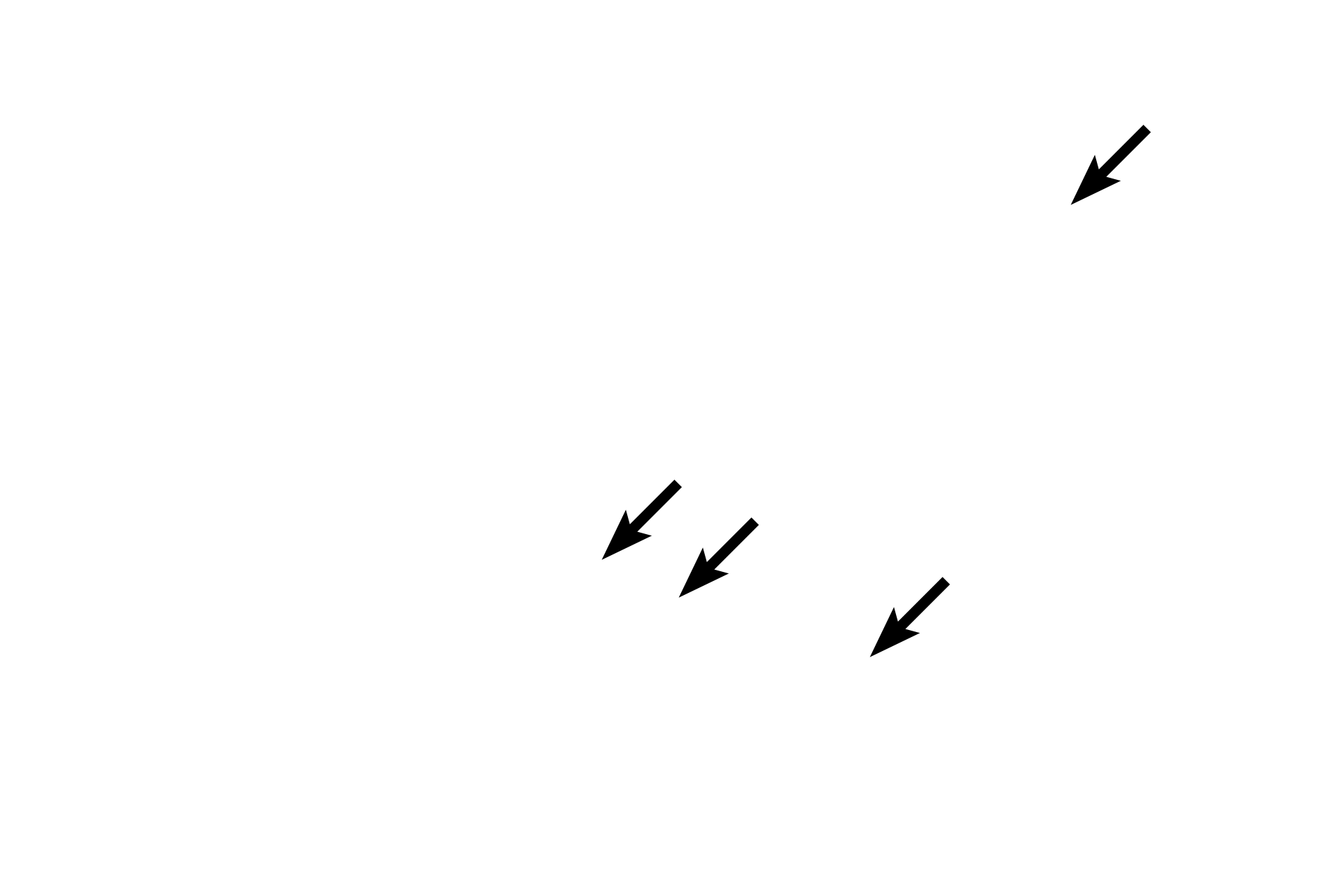 Sarcolemma <p>A unique feature of smooth muscle fibers is the presence of “inch-worm” nuclei. This appearance is caused by the criss-crossing of myofilaments in the cytoplasm deforming the nucleus during contraction.  The central, “inch-worm” nuclei, when present, and the absence of striations are good identifiers for smooth muscle in longitudinal section.  1000x</p>
