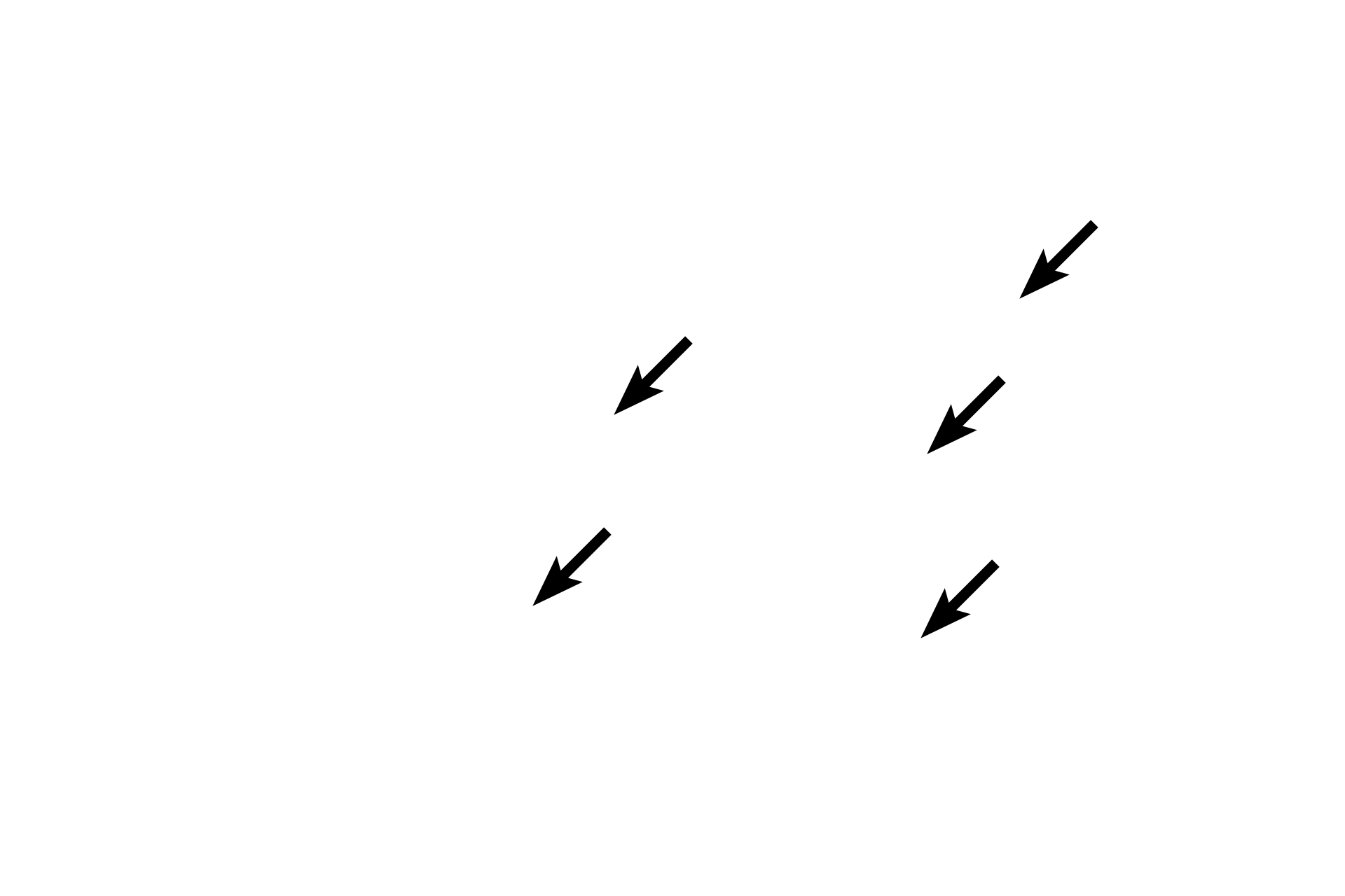Muscle fibers <p>The diameter of smooth muscle fibers varies in cross section because the fibers are cut at different locations along these spindle-shaped fibers.  In addition, since the nucleus is located midway along the fiber, most cross sections of fibers will not pass through the nucleus.  1000x</p>
