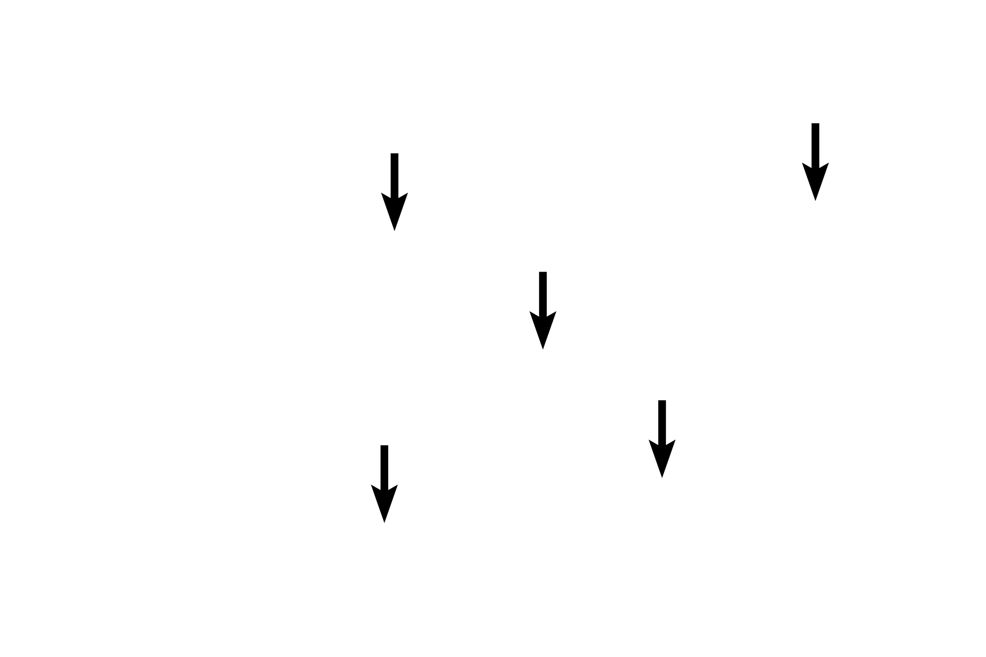 Nuclei <p>The diameter of smooth muscle fibers varies in cross section because the fibers are cut at different locations along these spindle-shaped fibers.  In addition, since the nucleus is located midway along the fiber, most cross sections of fibers will not pass through the nucleus.  1000x</p>
