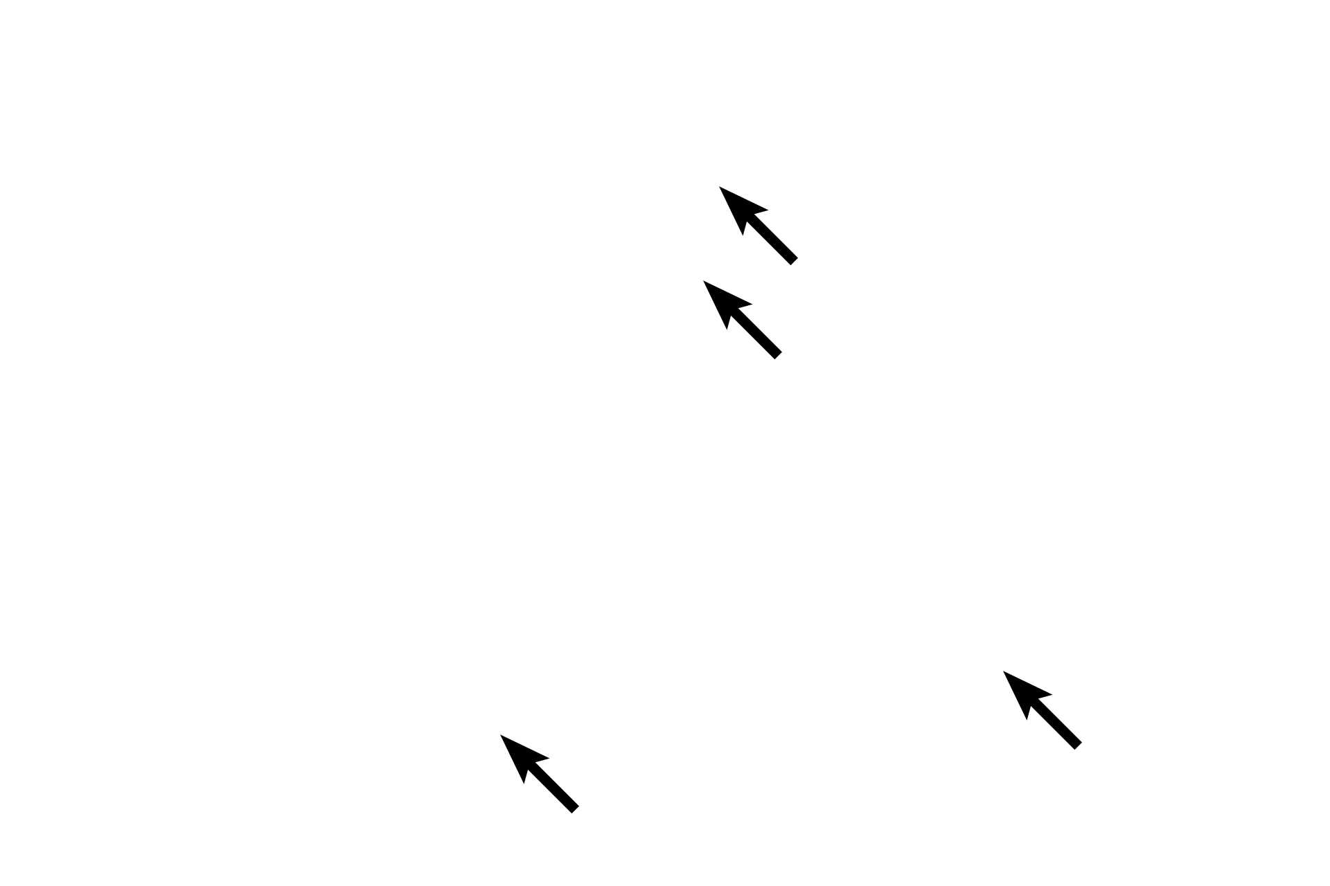 Nuclei <p>This smooth muscle is cut in cross and longitudinal section.  In the cross sections, diameters of profiles vary, indicative of the spindle shape of the fibers.  In addition, since the nucleus is located midway along the fiber, most cross sections will not pass through the nucleus.  A ganglion with autonomic neurons is also visible between the two layers.  1000x</p>
