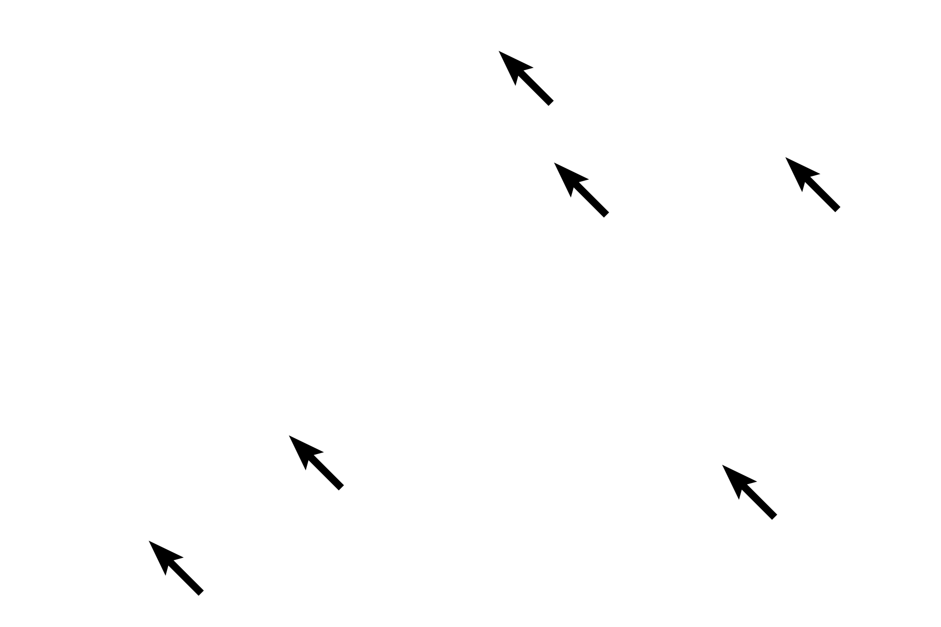 Muscle nuclei <p>Between these cross and longitudinal sections of smooth muscle is a region of dense irregular CT containing large collagen bundles.  When compared with smooth muscle, the CT appears more dispersed, and the heterochromatic fibroblast nuclei contrast with the active, euchromatic muscle nuclei.  Smooth muscle is also more basophilic.  1000x</p>

