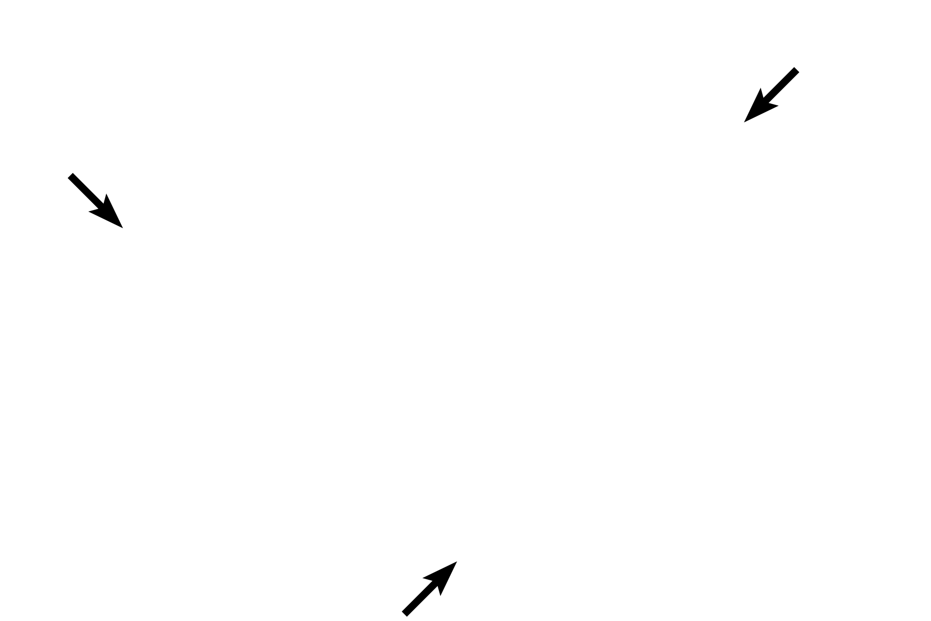 Dura mater > <p>The dura mater, the thick outermost membrane, is formed by dense connective tissue.  The dura mater contributes to the periosteum of the skull, but is a separate layer from the periosteum of the vertebrae.</p>
