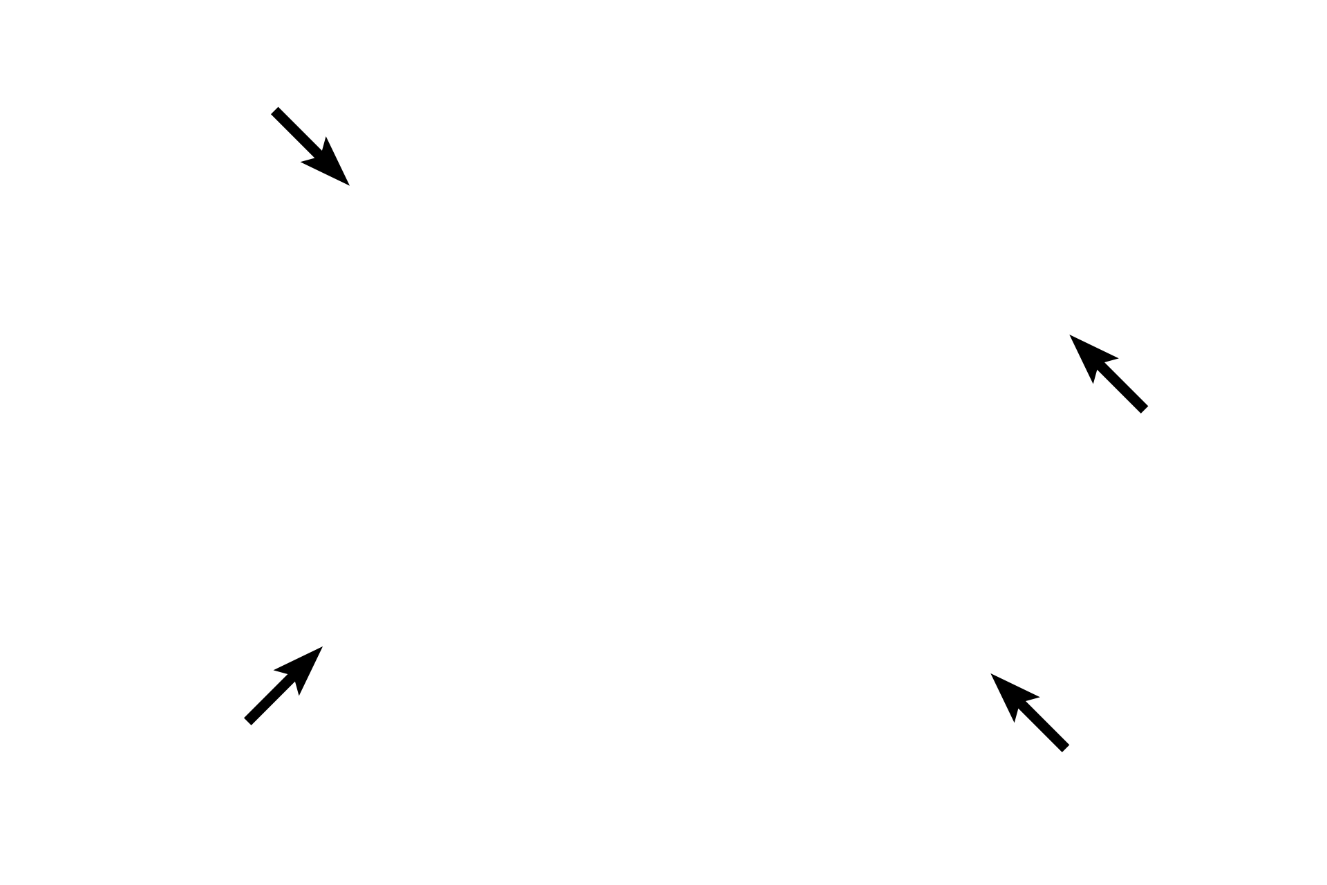 Arachnoid membrane > <p>The arachnoid is a delicate layer lying adjacent to the dura mater.  It sends weblike trabeculae through the subarachnoid space to the pia mater.  The subarachnoid space is filled with cerebrospinal fluid, providing a cushion for the brain or spinal cord.  Cranial and spinal nerve roots and blood vessels travel through this space.</p>
