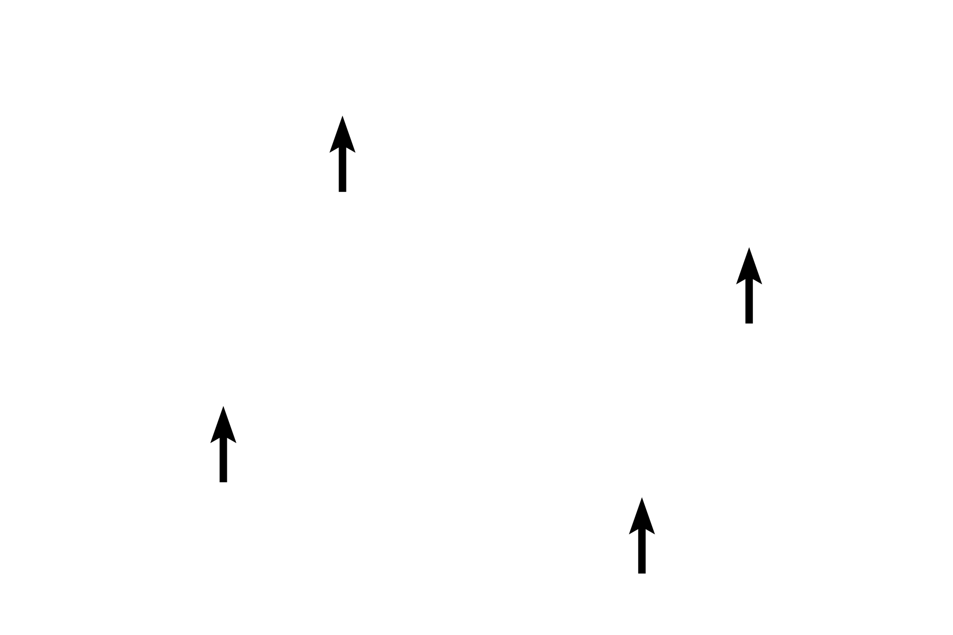 Subarachnoid space <p>The arachnoid is a delicate layer lying adjacent to the dura mater.  It sends weblike trabeculae through the subarachnoid space to the pia mater.  The subarachnoid space is filled with cerebrospinal fluid, providing a cushion for the brain or spinal cord.  Cranial and spinal nerve roots and blood vessels travel through this space.</p>
