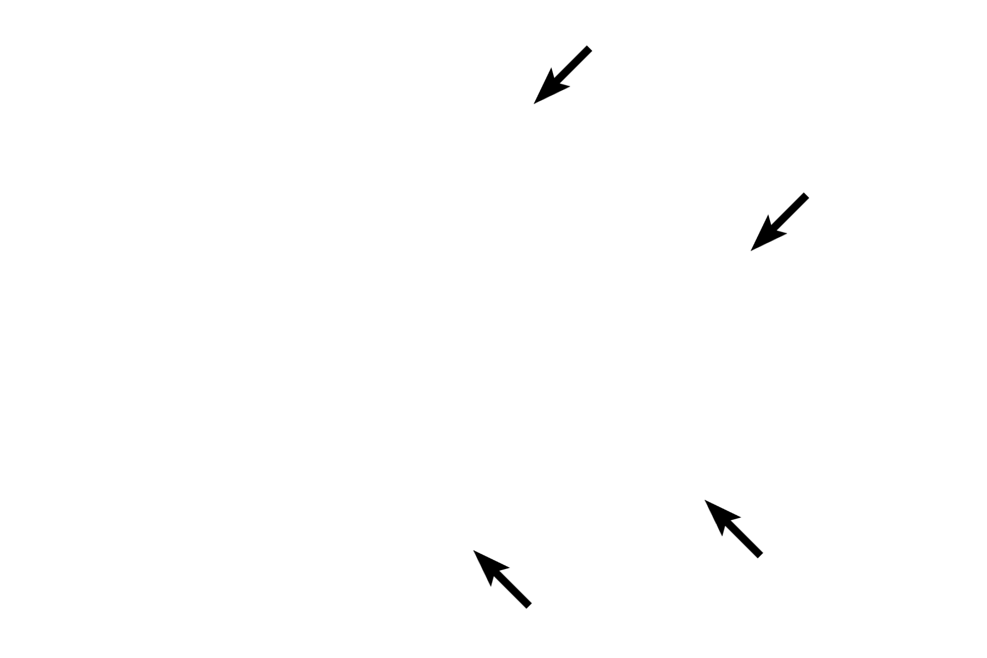 Blood vessels <p>The arachnoid is a delicate layer lying adjacent to the dura mater.  It sends weblike trabeculae through the subarachnoid space to the pia mater.  The subarachnoid space is filled with cerebrospinal fluid, providing a cushion for the brain or spinal cord.  Cranial and spinal nerve roots and blood vessels travel through this space.</p>
