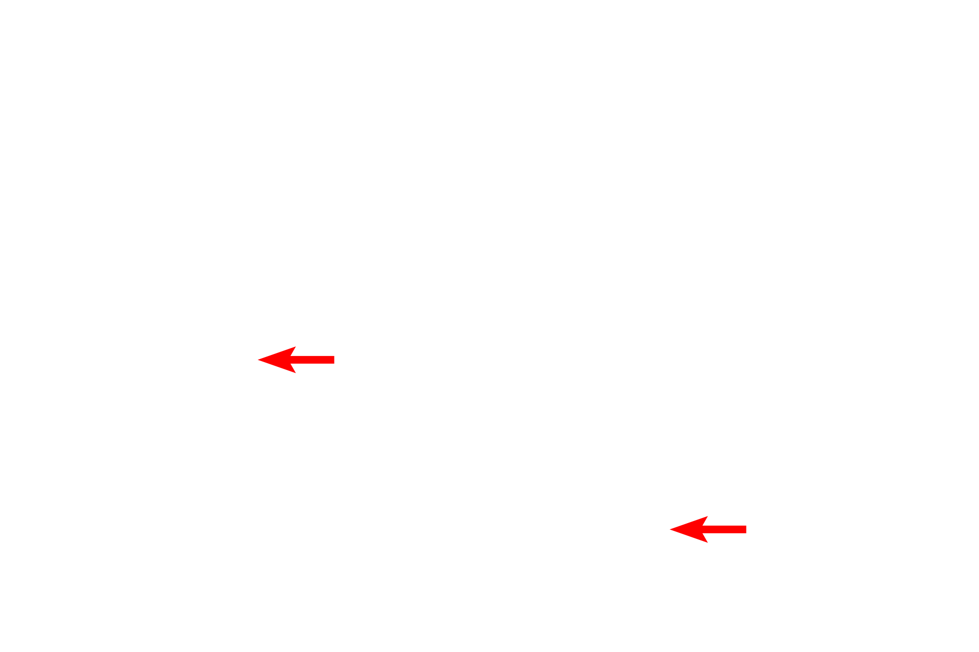 Axon > <p>Most neurons have a single axon that maintains a fairly uniform diameter.  At its termination, the axon branches, forming a terminal arborization.  Axons originate from a specialized region of the cell body called the axon hillock and are usually longer than dendrites.  Axons transmit impulses away from the cell body.</p>
