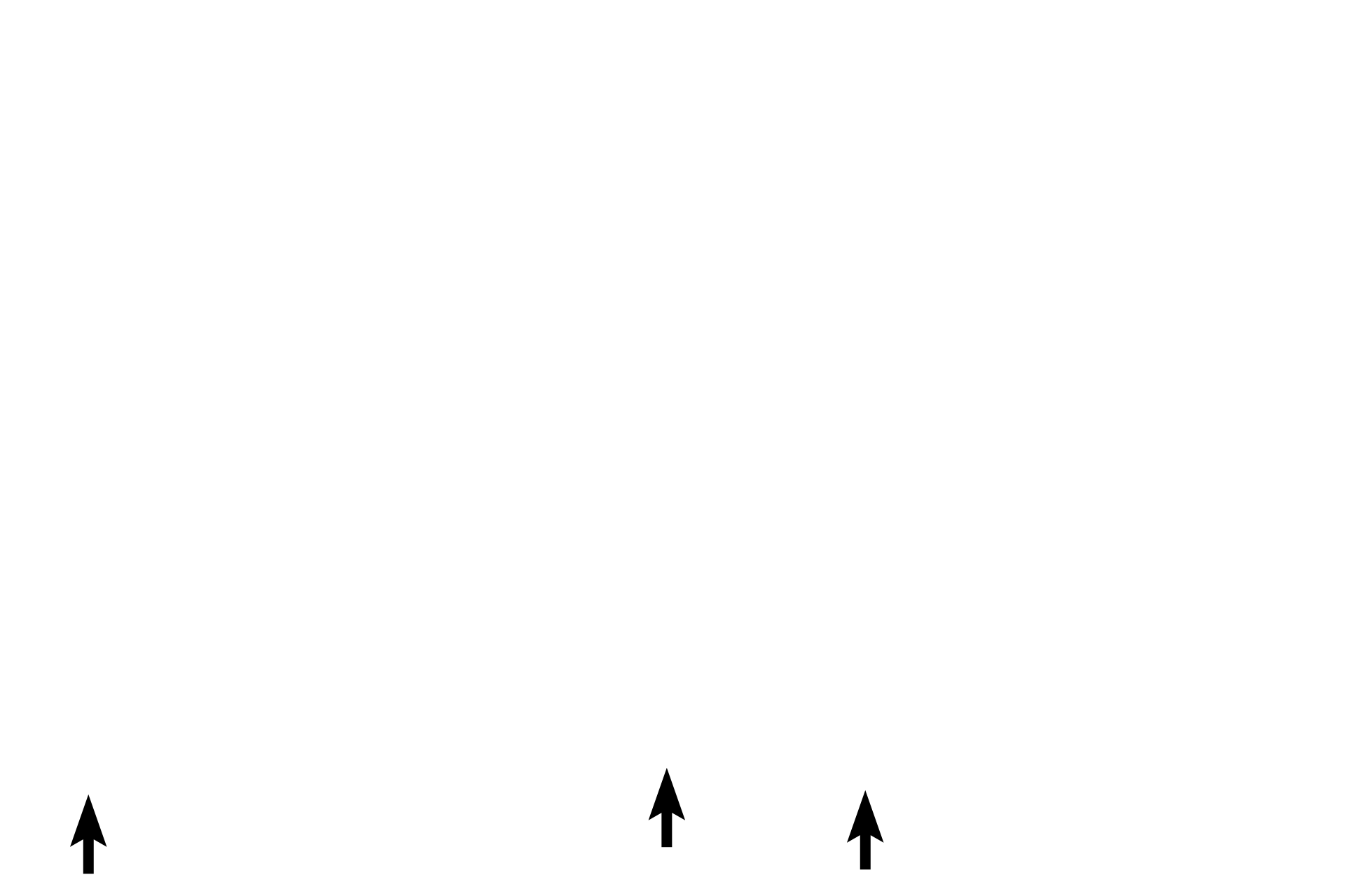  -- Ventral root > <p>The ventral root of a spinal nerve carries motor information via multipolar neurons (in red) from the CNS to effector structures, such as muscles, glands, or other neurons.  The nerve cell body for each multipolar neuron is located in the grey matter of the spinal cord; the axon of each neuron exits via the ventral root.</p>
