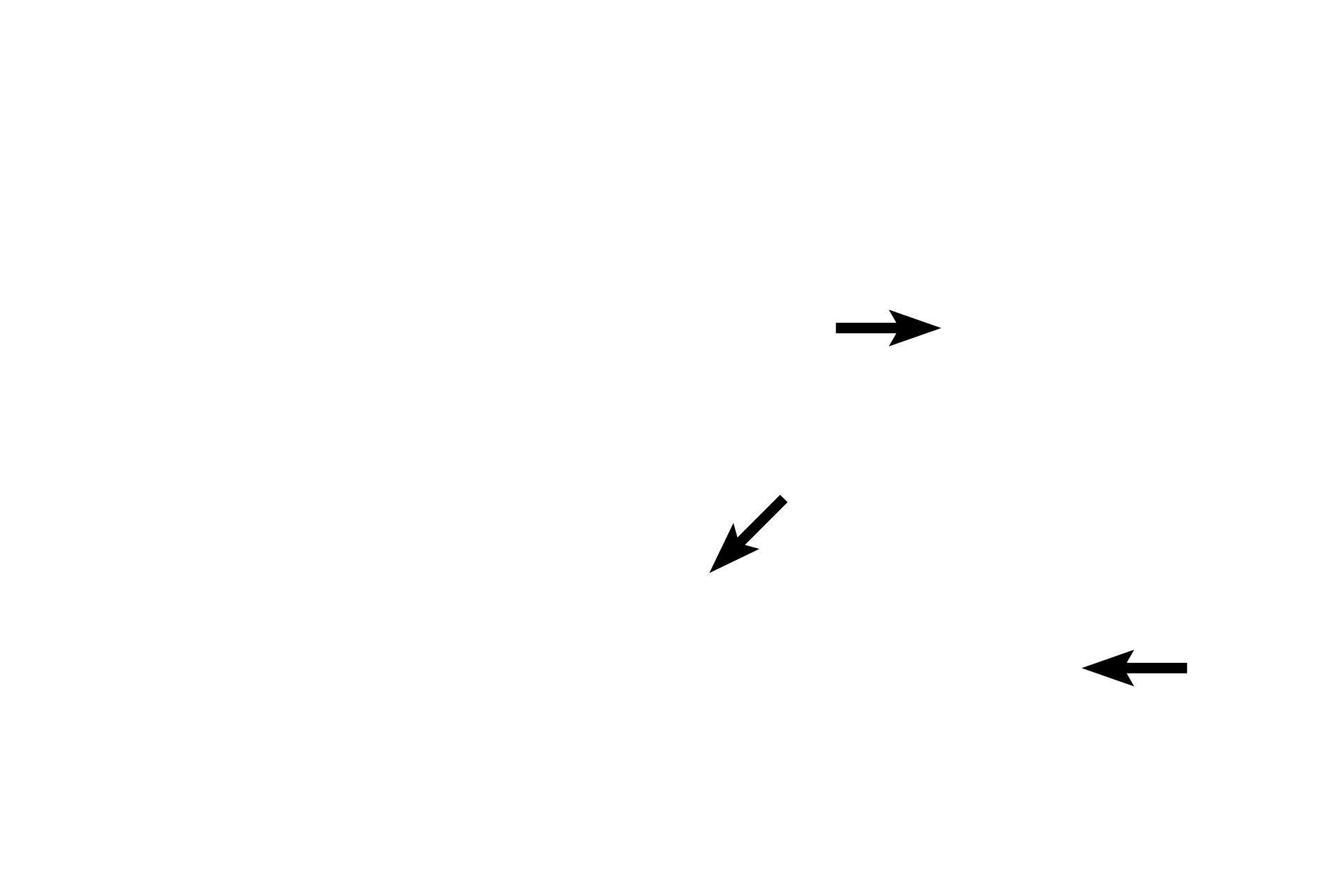 Sensory neurons > <p>Sensory information is carried into the CNS by pseudounipolar neurons (in blue).  These sensory neurons begin at the receptor and have their cell bodies located either in a dorsal root ganglion (as illustrated here) or in a sensory ganglion of a cranial nerve.  The central process of each neuron terminates in the CNS.</p>
