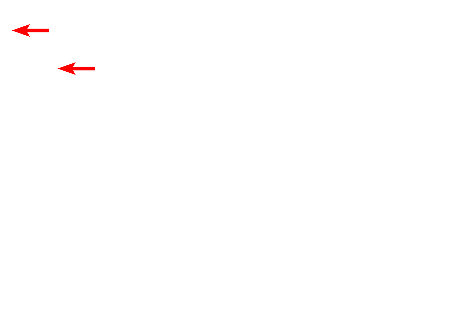 Unmyelinated axons > <p>In general, axons with diameters of less than one micron are not myelinated.  In this case, multiple axons indent the surface of a single Schwann cell and are surrounded by a single wrapping of the Schwann cell plasma membrane.</p>
