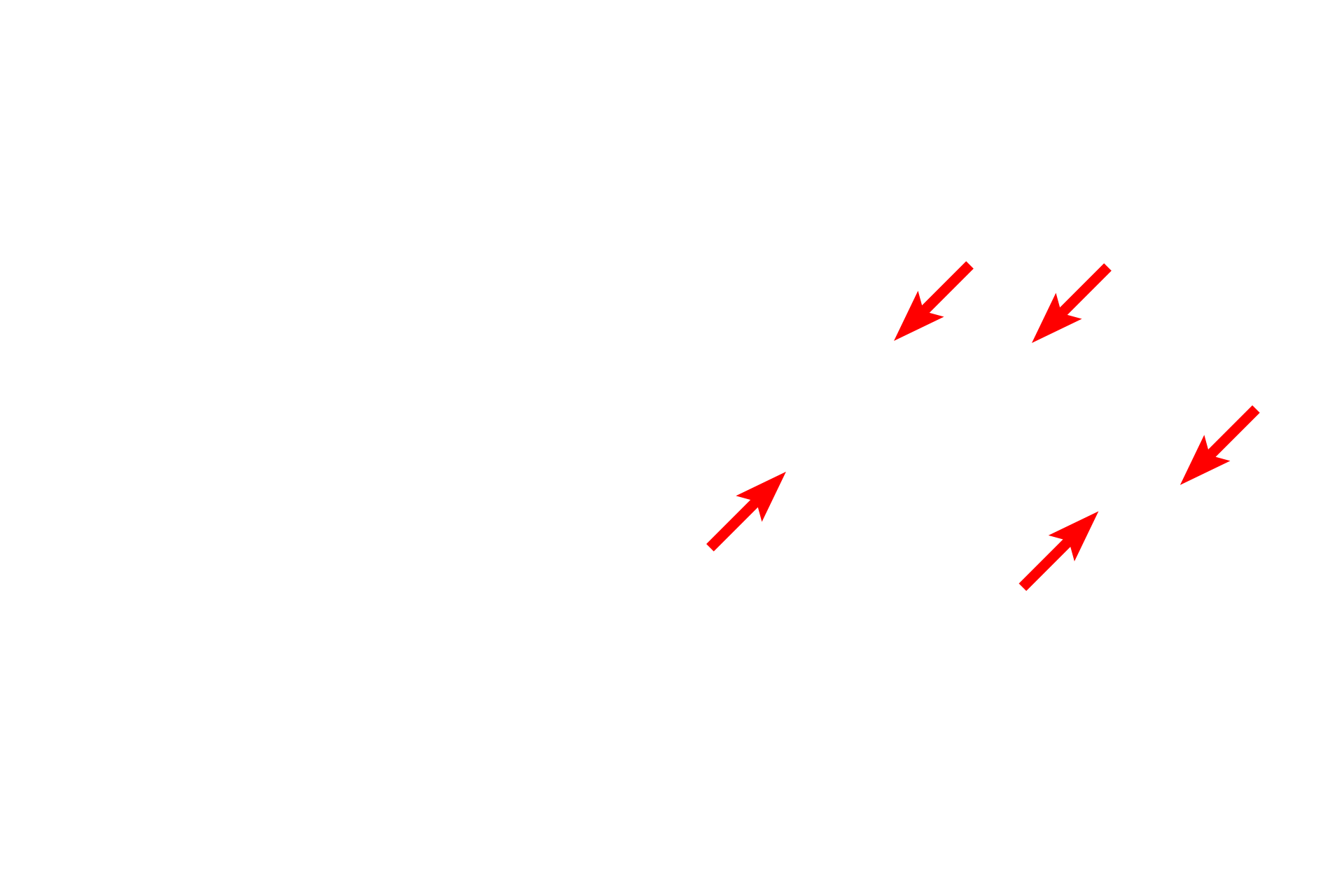 Schwann cell plasma membrane <p>In general, axons with diameters of less than one micron are not myelinated.  Multiple axons indent the surface of a single Schwann cell and are surrounded by a single wrapping of the Schwann cell plasma membrane.  These axons conduct at a slower velocity than their myelinated counterparts.  1000x, 15,000x</p>

