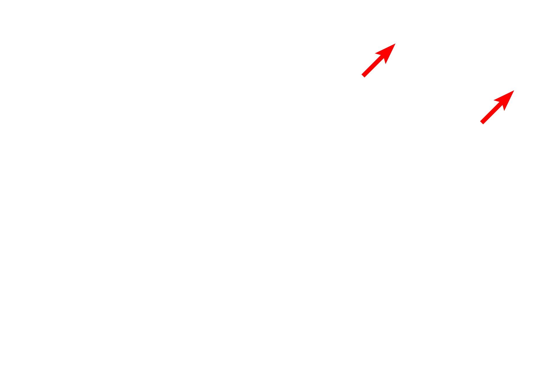Collagen fibrils <p>In general, axons with diameters of less than one micron are not myelinated.  Multiple axons indent the surface of a single Schwann cell and are surrounded by a single wrapping of the Schwann cell plasma membrane.  These axons conduct at a slower velocity than their myelinated counterparts.  1000x, 15,000x</p>
