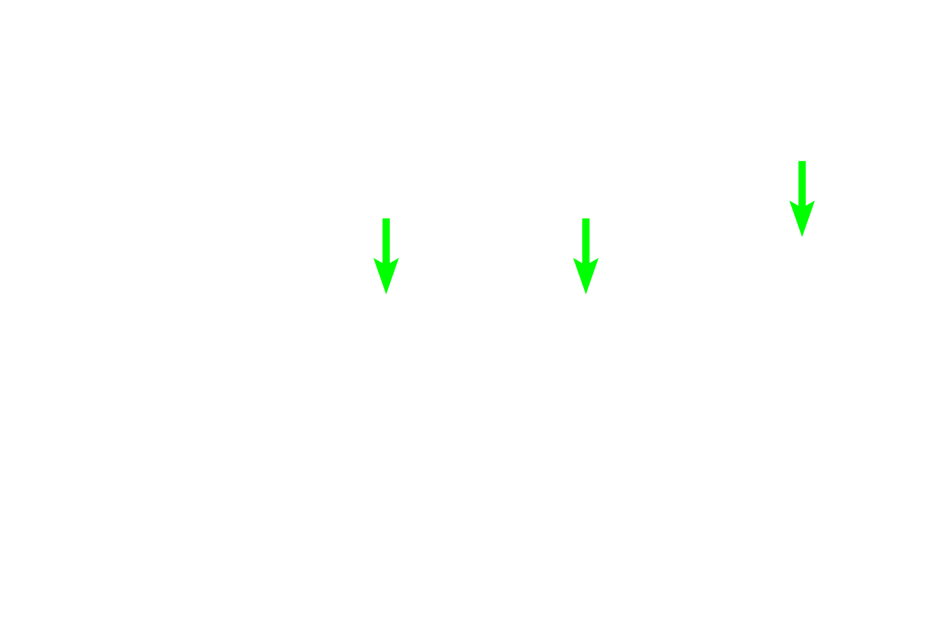 Peripheral nerves <p>Peripheral nerves can be found coursing through tissues of the body.  Generally, nerves appear well demarcated from surrounding tissue due to the presence of the perineurium.  Nerves do not have a lumen and often have a wavy appearance in longitudinal section.  These two characteristics distinguish nerves from blood vessels or the ducts of glands.  400x</p>
