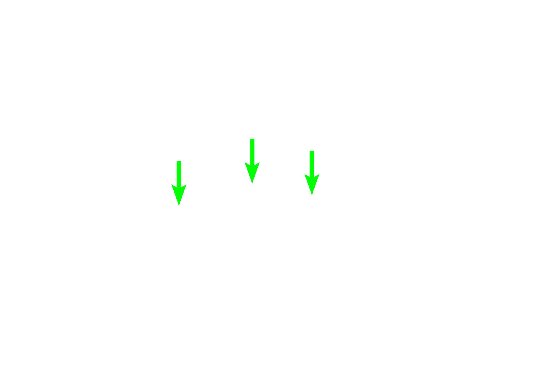 Perineurium <p>Peripheral nerves can be found coursing through tissues of the body.  Generally, nerves appear well demarcated from surrounding tissue due to the presence of the perineurium.  Nerves do not have a lumen and often have a wavy appearance in longitudinal section.  These two characteristics distinguish nerves from blood vessels or the ducts of glands.  400x</p>
