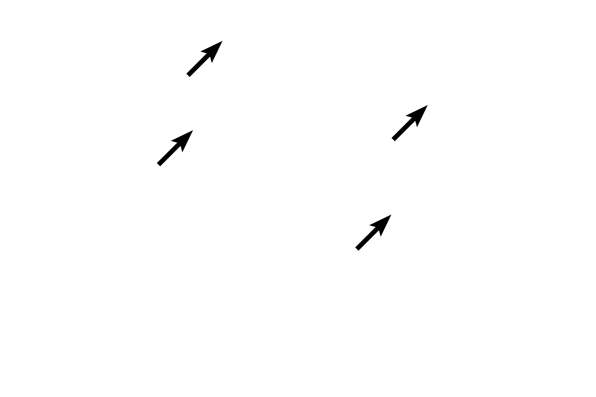Dense irregular connective tissue <p>A longitudinal section of a peripheral nerve lies adjacent to a muscular artery.  Peripheral nerves often display a wavy appearance in tissue and appear well demarcated from the adjacent connective tissue by the presence of the perineurium.  400x</p>
