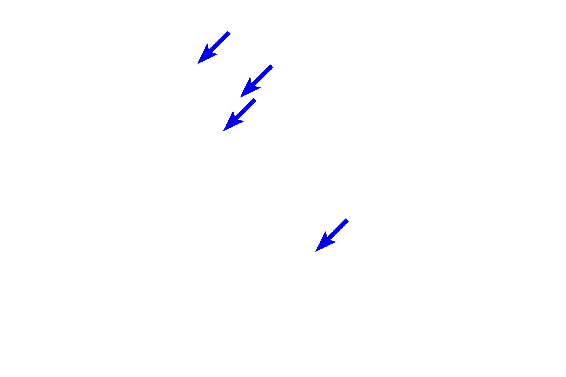 Myelinated axons <p>The dermis of the skin contains many peripheral nerves which convey both myelinated and unmyelinated axons.  Nerve fascicles are clearly outlined by their perineurium.  Also visible in the connective tissue are blood vessels and accumulations of adipocytes.  400x</p>
