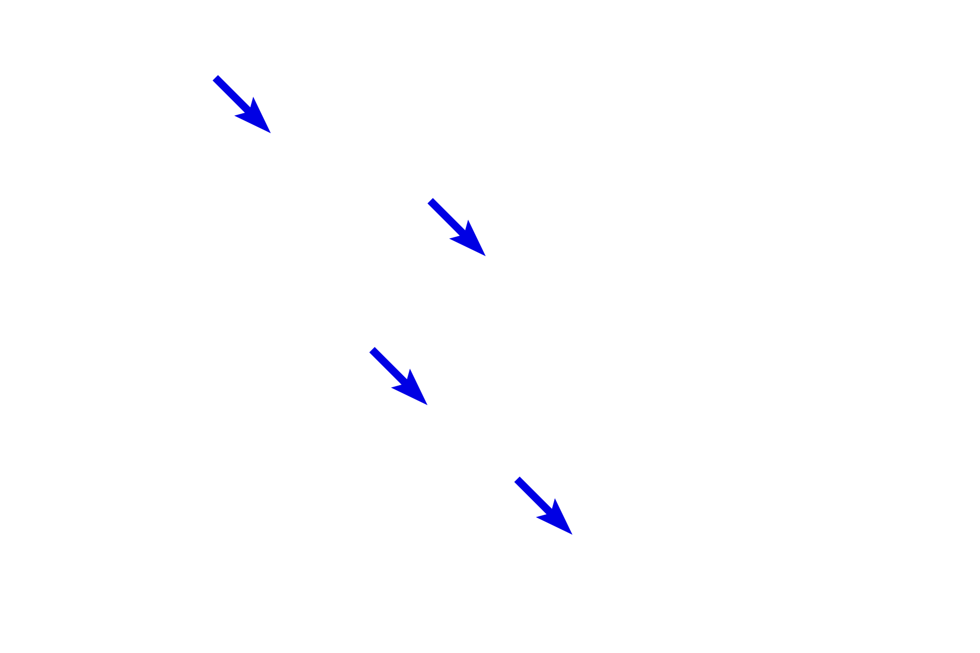 Perineurium <p>The dermis of the skin contains many peripheral nerves which convey both myelinated and unmyelinated axons.  Nerve fascicles are clearly outlined by their perineurium.  Also visible in the connective tissue are blood vessels and accumulations of adipocytes.  400x</p>
