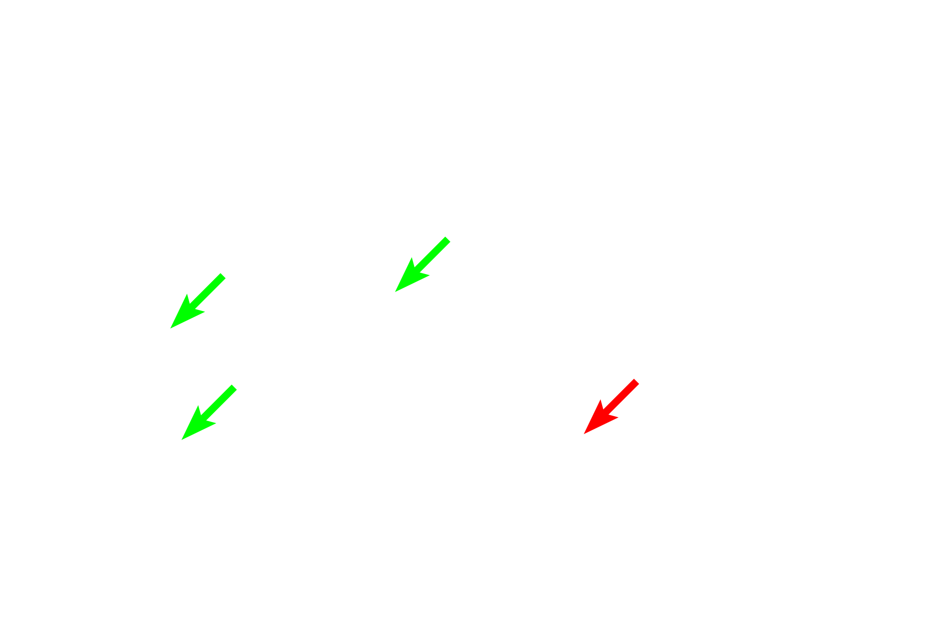 Schwann cell nuclei <p>These cross sections of peripheral nerves contain unmyelinated axons.  Each nerve is surrounded by a distinct perineurium.  1000x, 3000x</p>
