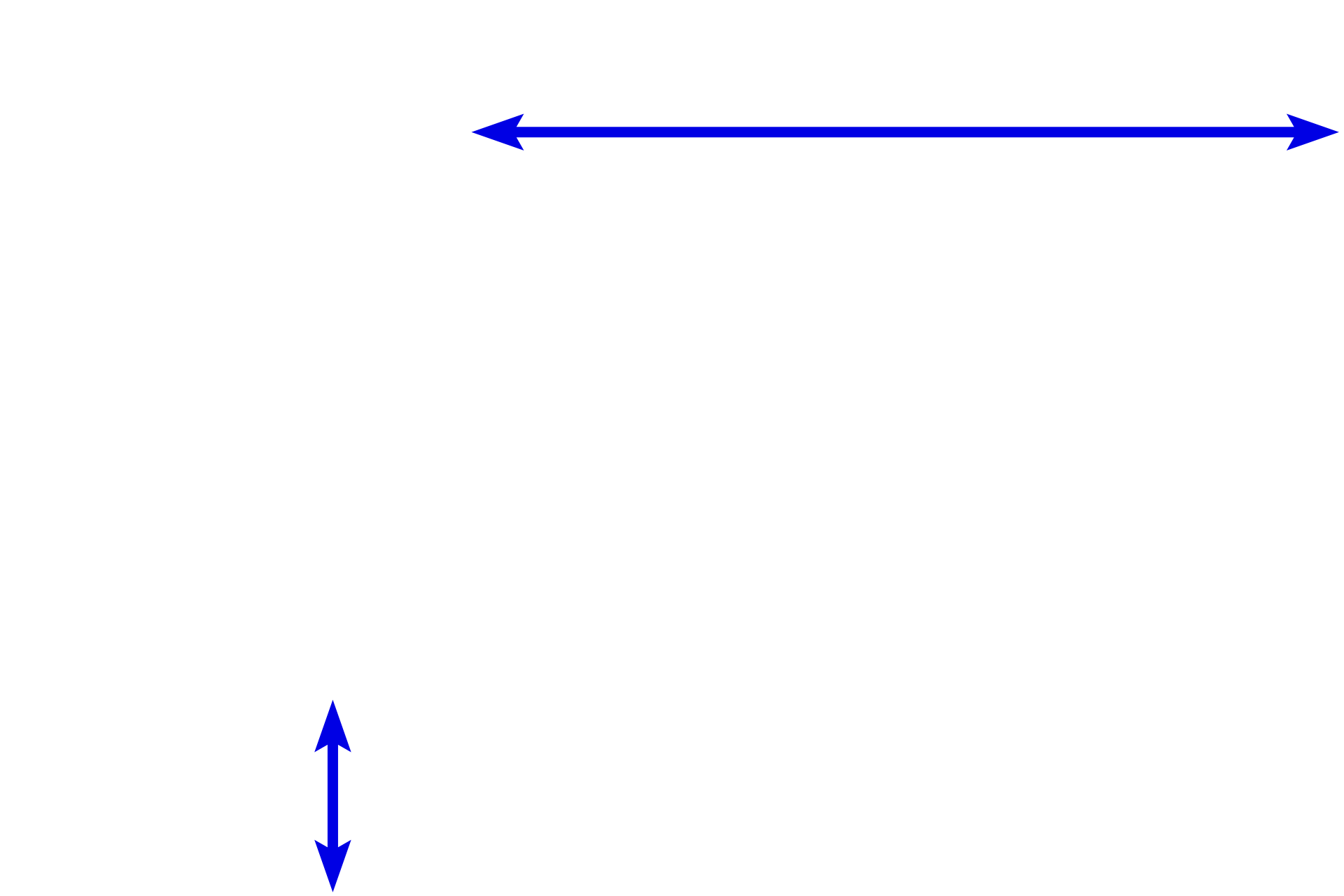 Nerve fascicles <p>At higher magnification the histological distinctions between the perineurium and epineurium are seen.  The perineurium is more basophilic, highly cellular and very compact.  In contrast, the epineurium is more eosinophilic, contains collagen fibers and fewer cells.  Note myelinated axons of various sizes and Schwann cell nuclei.  400x</p>
