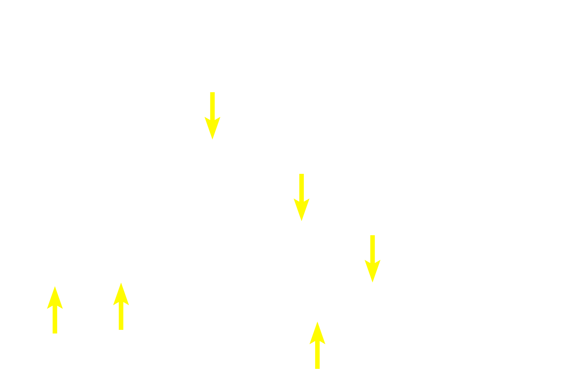 Epineurium > <p>The epineurium consists of a dense irregular connective tissue of collagen bundles that blends with the surrounding connective tissue.  Epineurium surrounds larger trunks of peripheral nerves and is lost as peripheral nerves decrease in size.</p>
