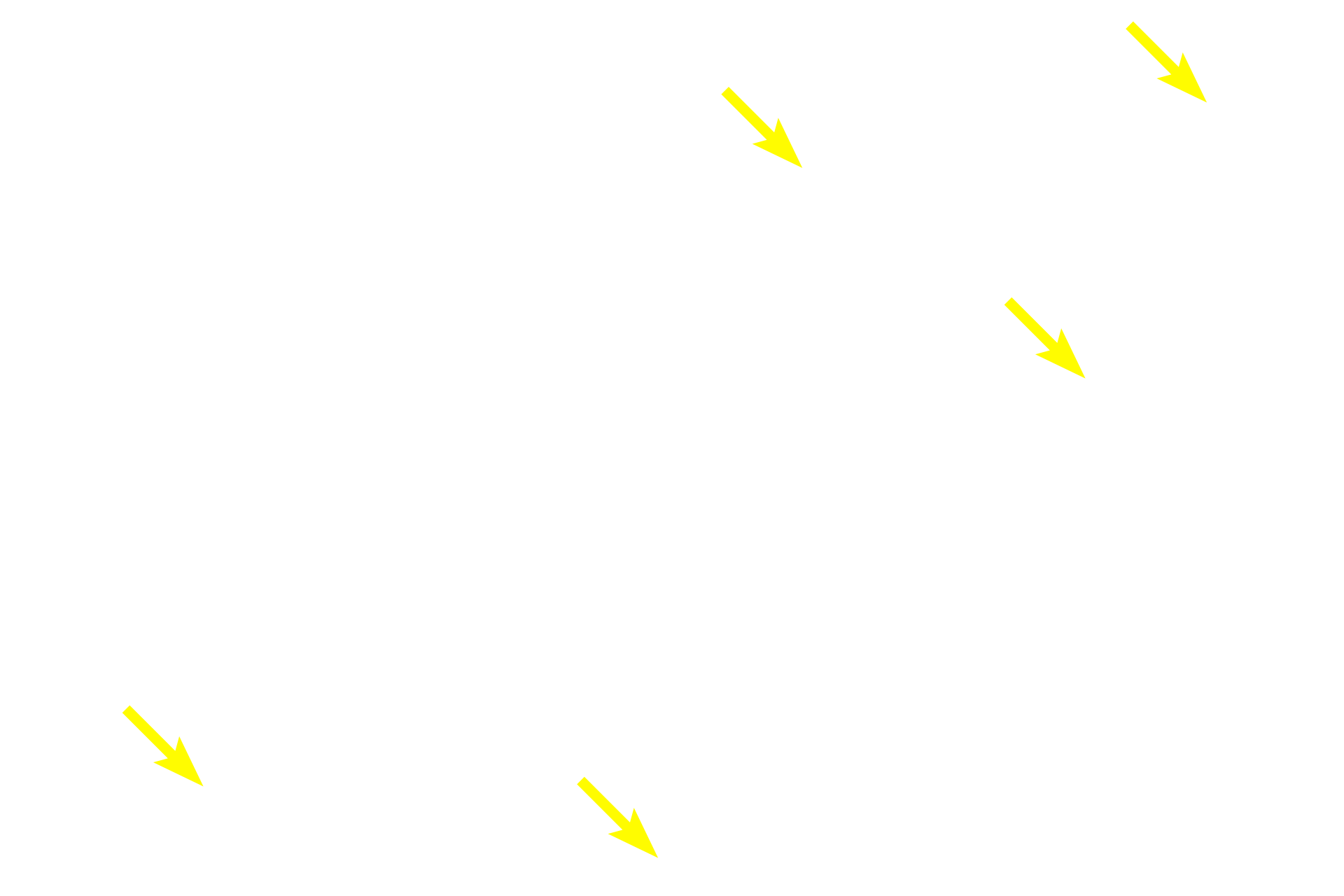 Schwann cell nuclei <p>At higher magnification the histological distinctions between the perineurium and epineurium are seen.  The perineurium is more basophilic, highly cellular and very compact.  In contrast, the epineurium is more eosinophilic, contains collagen fibers and fewer cells.  Note myelinated axons of various sizes and Schwann cell nuclei.  400x</p>
