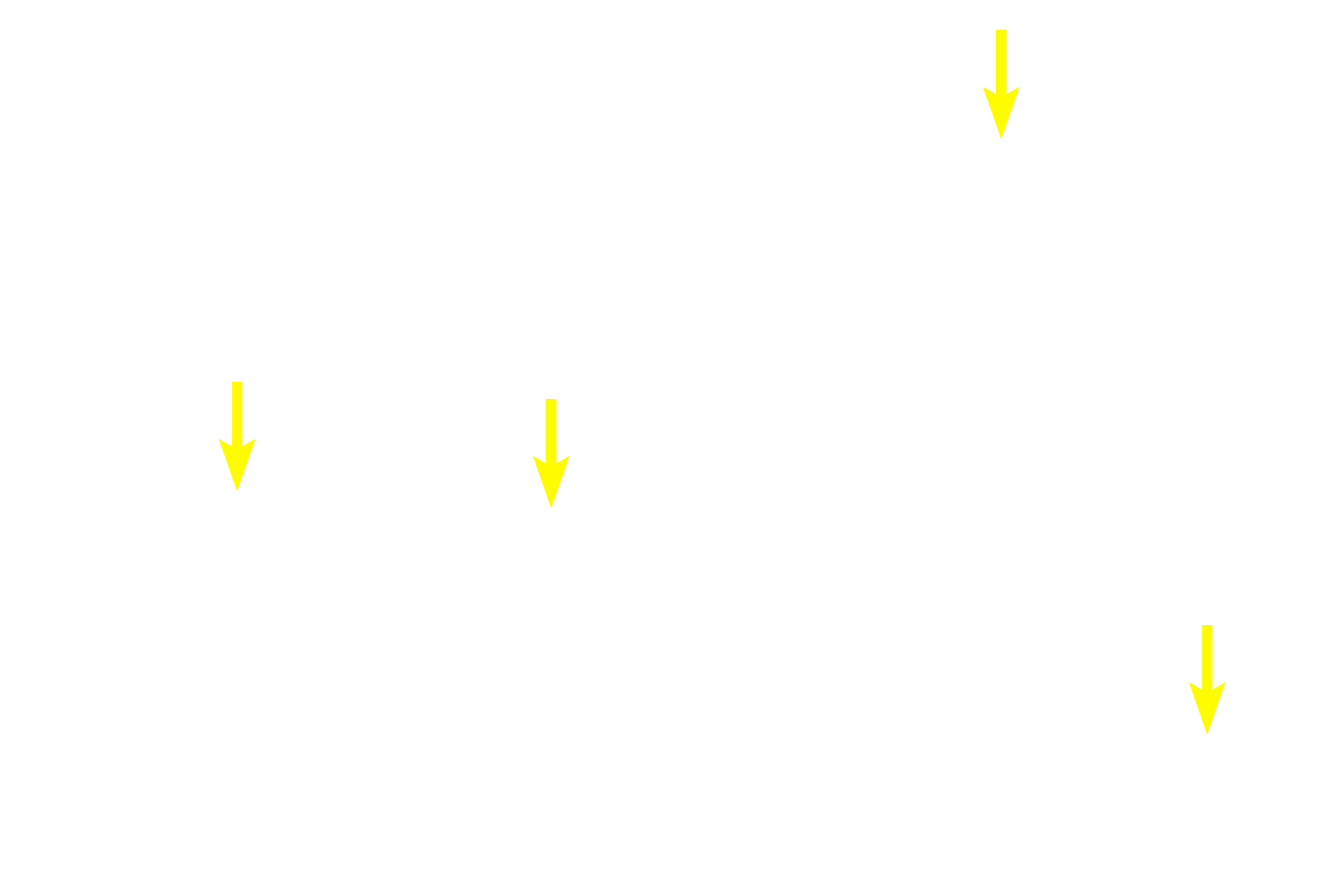 Blood vessels <p>At higher magnification the histological distinctions between the perineurium and epineurium are seen.  The perineurium is more basophilic, highly cellular and very compact.  In contrast, the epineurium is more eosinophilic, contains collagen fibers and fewer cells.  Note myelinated axons of various sizes and Schwann cell nuclei.  400x</p>
