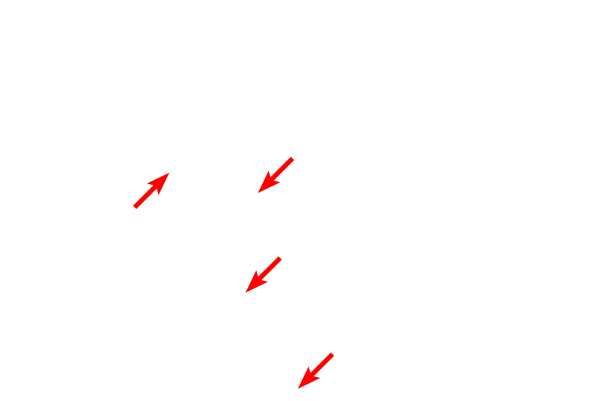 Schwann cell nuclei <p>The myelin sheath in this section shows prominently because the tissue was fixed with osmium, retaining the lipid components of myelin.  Individual Schwann cells can either associate with a single axon, forming a myelin sheath, or can invest multiple axons, which are then referred to as unmyelinated.  Toluidine blue stain,  1000x</p>
