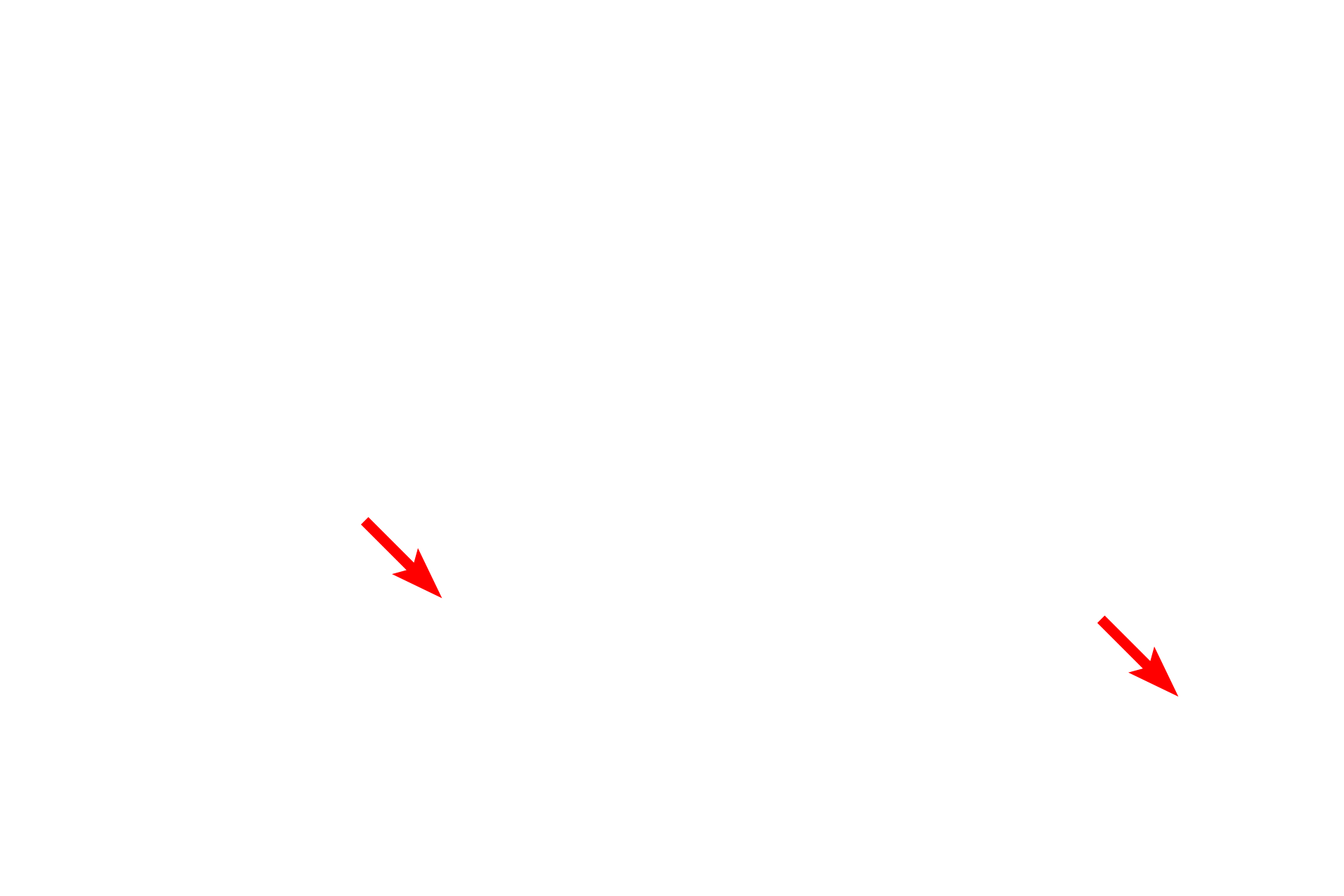 Mast cells <p>The myelin sheath in this section shows prominently because the tissue was fixed with osmium, retaining the lipid components of myelin.  Individual Schwann cells can either associate with a single axon, forming a myelin sheath, or can invest multiple axons, which are then referred to as unmyelinated.  Toluidine blue stain,  1000x</p>

