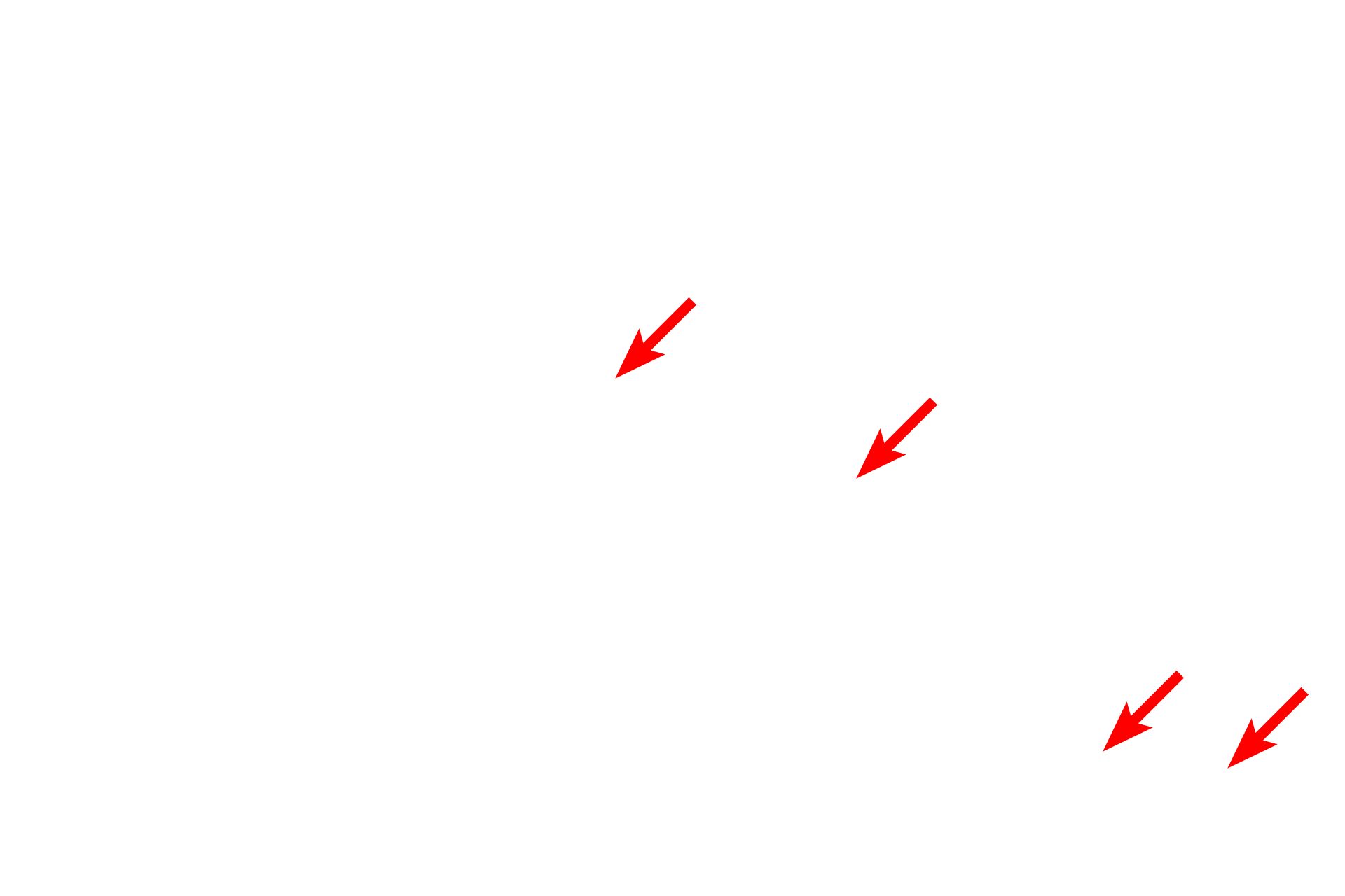 Endoneurium > <p>The endoneurium is composed of fibroblasts and collagen fibrils interspersed between the Schwann cells and the axons they ensheath.</p>
