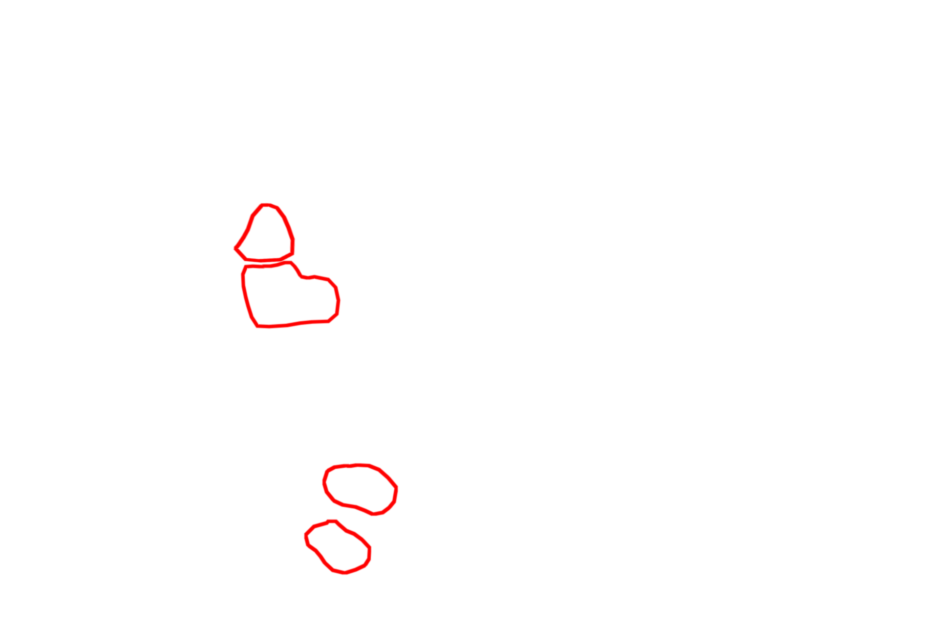 Unmyelinated axons > <p>Unmyelinated axons are generally less than one micron in diameter.  Unlike myelinated axons, multiple axons are associated with a single Schwann cell (circled in red); each axon is embedded in a longitudinal indentation of the Schwann cell surface.  Each of the numerous unmyelinated axons, resembling a white dot, is just resolvable at this magnification within the outlines.</p>
