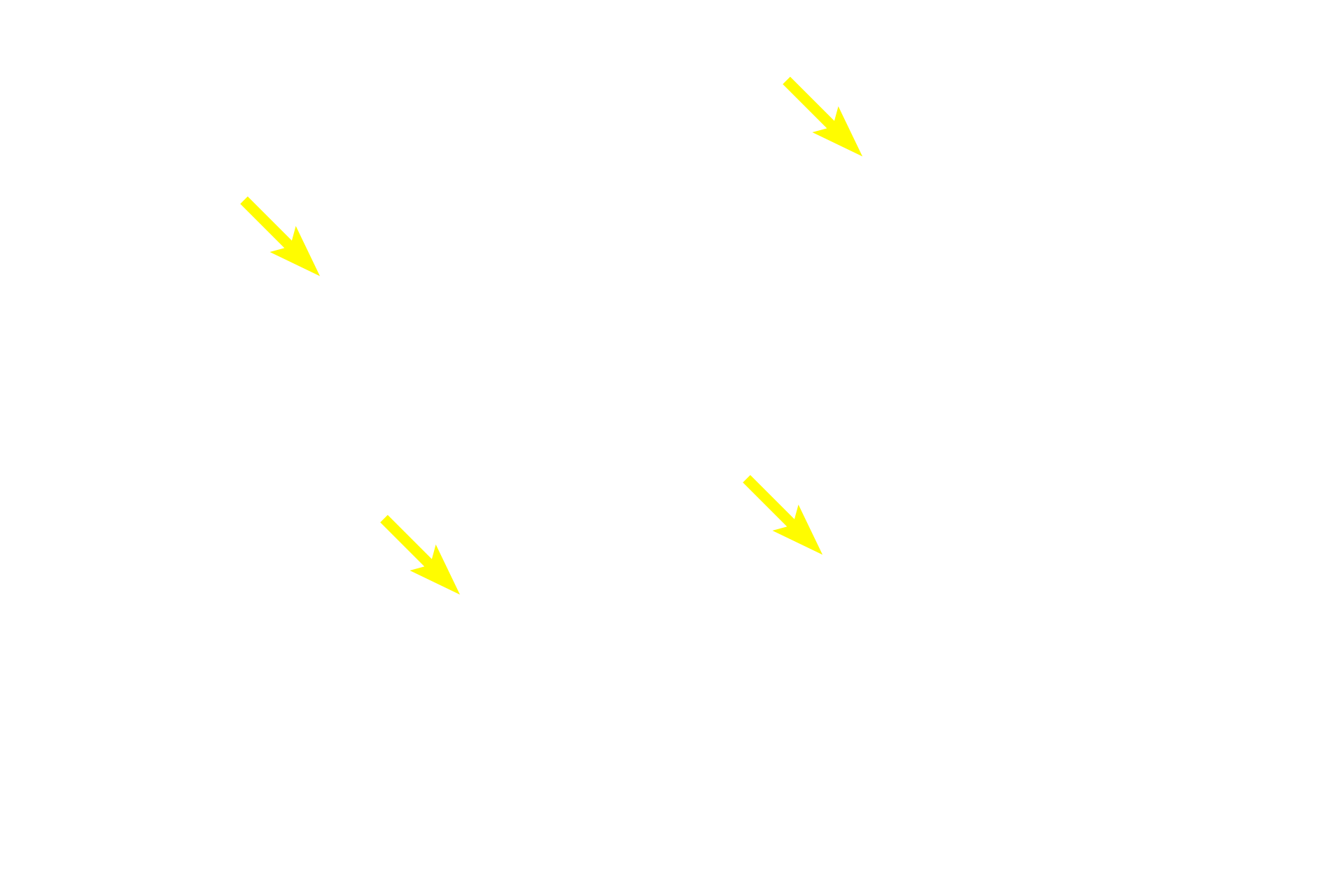 Axons <p>A longitudinal section of a nerve fascicle, shows several myelinated axons.  Two nodes of Ranvier are  visible between adjacent internodes of the myelin sheath.  The axon can be seen passing through the nodal region; Schwann cell nuclei are visible between vacuolated-appearing myelin sheaths.  1000x</p>
