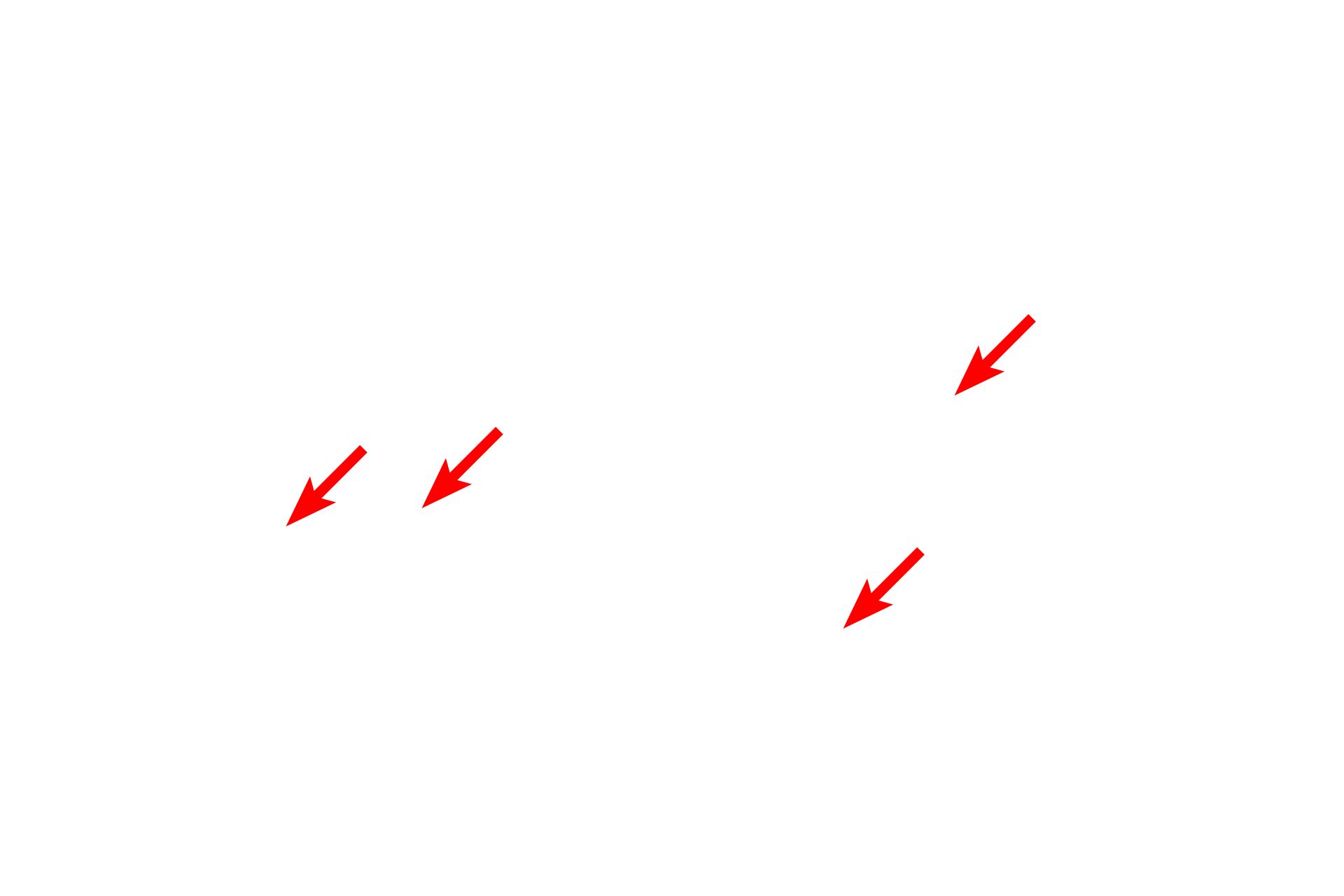 - Paranodal loops <p>The paranode is the subdivision of the segmental myelin unit located between the node of Ranvier and the internode.  The paranode consists of folds of Schwann cell membrane forming paranodal loops.  The paranodal loops contain Schwann cell cytoplasm, and the membranes form attachments that anchor the myelin segment to the axonal plasma membrane.</p>
