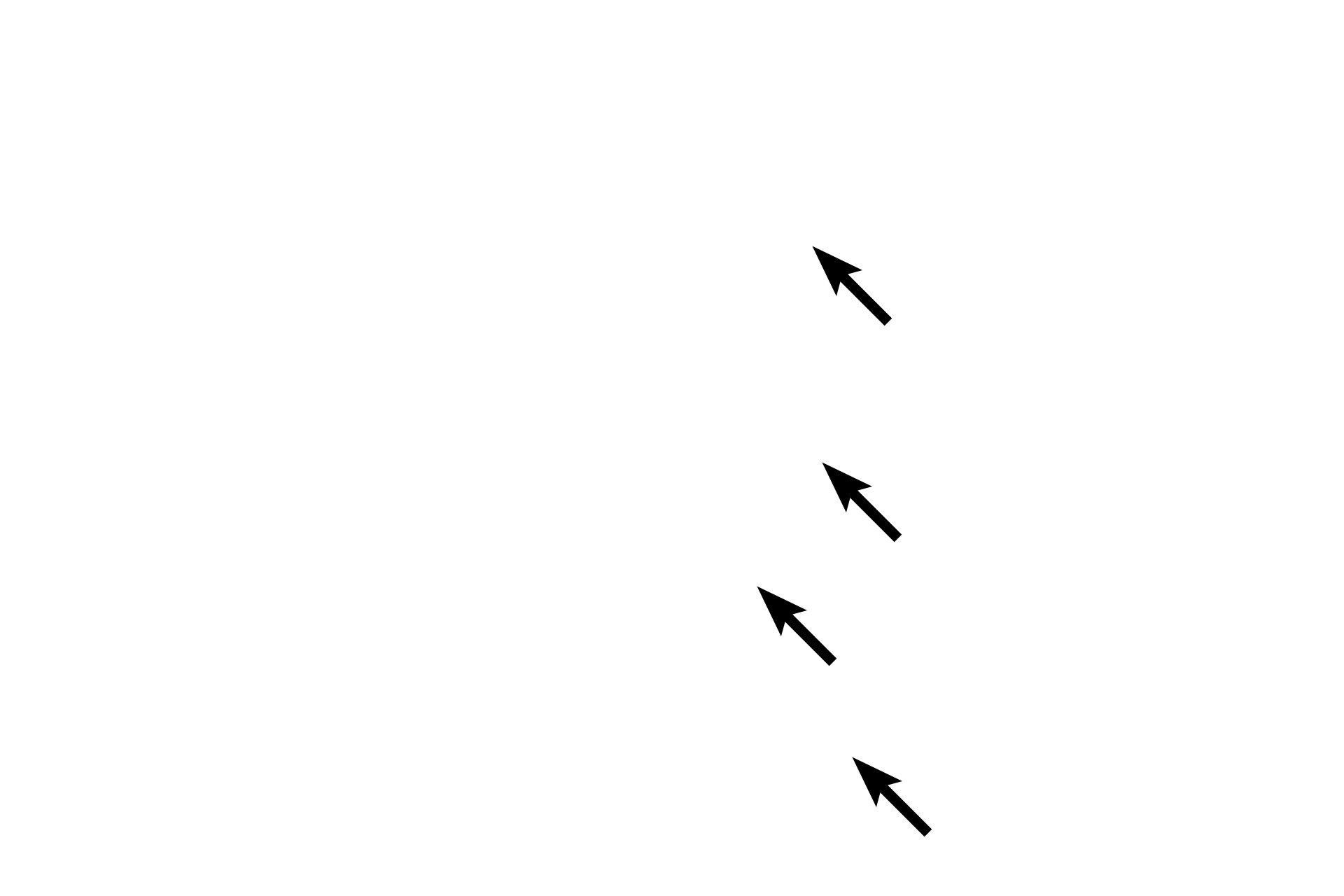 Endoneurial and Schwann cells <p>Pacinian corpuscles consist of concentric layers of endoneurial cells and Schwann cells, which surround a central, unmyelinated axon.  When cut in cross section, the internal structure of the receptor resembles a sliced onion, and the lymph-like fluid between the lamellae allows the receptor to adapt and respond to stimuli for deep pressure and vibration.</p>
