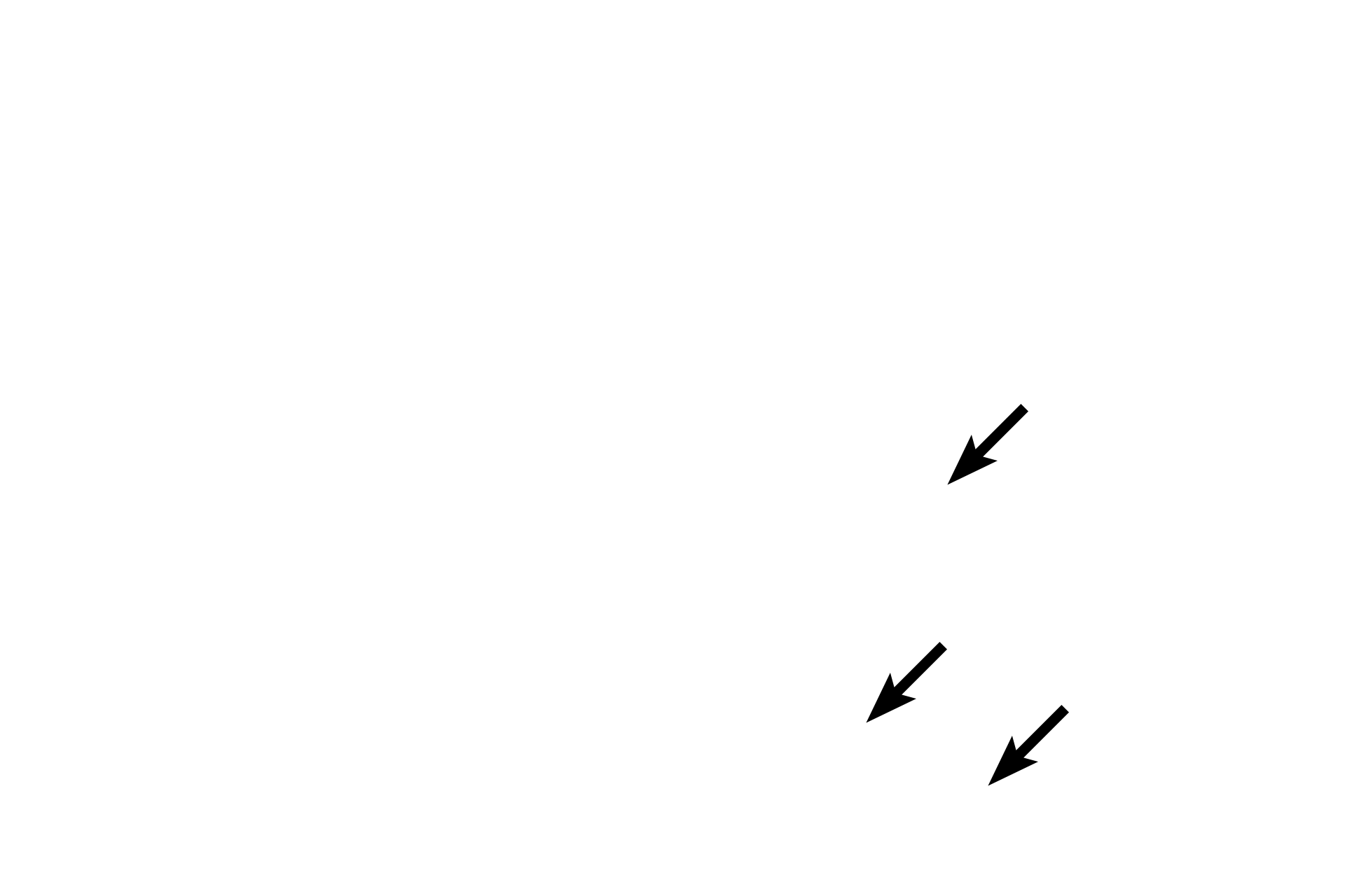 Connective tissue <p>Meissner’s corpuscles, encapsulated sensory receptors located in connective tissue of skin beneath the epithelium (epidermis), provide fine touch discrimination and are most concentrated in finger tips and lips.  These corpuscles consist of Schwann cells, spiraling like a spring around an unmyelinated sensory axon.  Deformation of the spring generates action potentials in the axon.</p>
