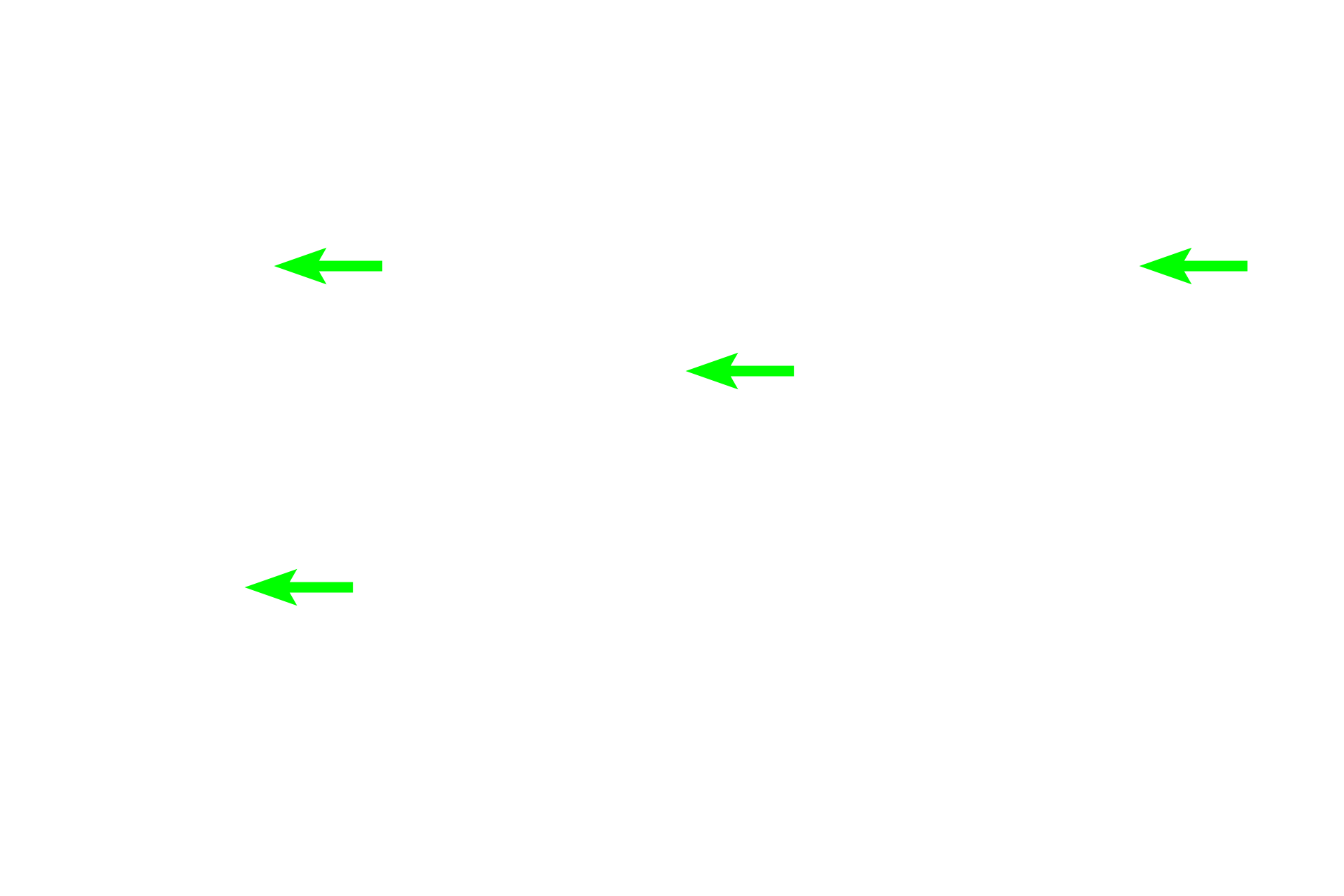 Skeletal muscle fibers <p>Contraction of skeletal muscle is initiated by depolarization of the sarcolemma at the neuromuscular junction (NMJ) or motor end plate. NMJs are specialized synapses between axon terminals of multipolar motor neurons and the sarcolemma beneath them.  Here, several axons are terminating in NMJs on skeletal muscle fibers.  The motor neuron plus all the skeletal muscle fibers it innervates is a motor unit.</p>
